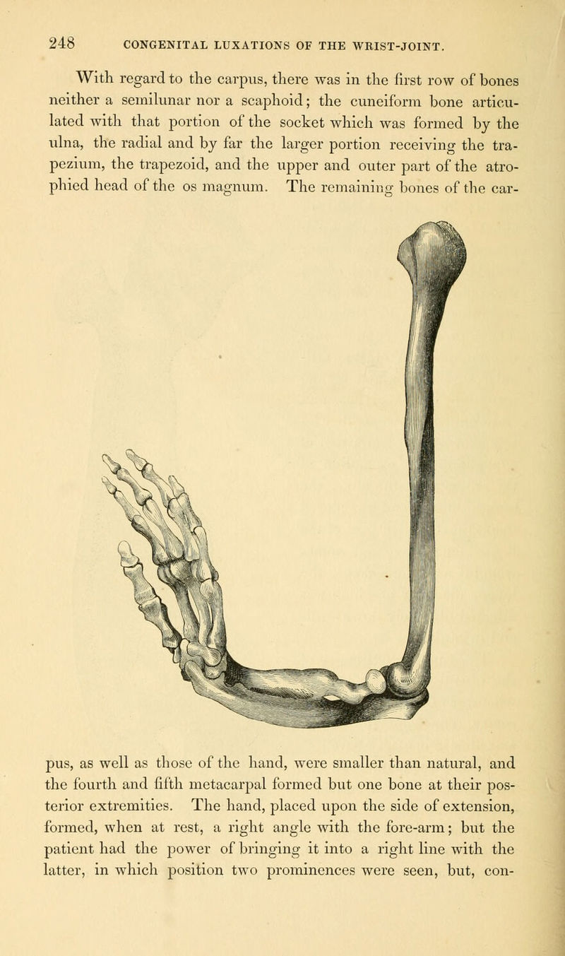 With regard to the carpus, there was in the first row of bones neither a semilunar nor a scaphoid; the cuneiform bone articu- lated with that portion of the socket which was formed by the ulna, the radial and by far the larger portion receiving the tra- pezium, the trapezoid, and the upper and outer part of the atro- phied head of the os magnum. The remaining bones of the car- pus, as well as those of the hand, were smaller than natural, and the fourth and fifth metacarpal formed but one bone at their pos- terior extremities. The hand, placed upon the side of extension, formed, when at rest, a right angle with the fore-arm; but the patient had the power of bringing it into a right line with the latter, in which position two prominences were seen, but, con-
