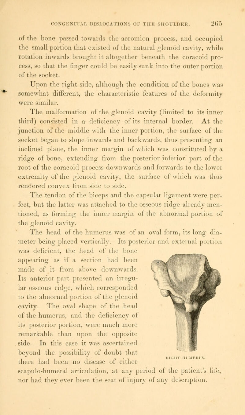 of the bone passed towards the acromion process, and occupied the small portion that existed of the natural glenoid cavity, while rotation inwards broughl it altogether beneath the coracoid pro- cess, so that the finger could be easily sunk into the outer portion of the socket. Upon the right side, although the condition of the bones was somewhat different, the characteristic features of the deformity Avere similar. The malformation of the glenoid cavity (limited to its inner third) consisted in a deficiency of its internal border. At the junction of the middle with the inner portion, the surface of the socket began to slope inwards and backwards, thus presenting an inclined plane, the inner margin of which was constituted by a ridge of bone, extending from the posterior inferior part of the root of the coracoid process downwards and forwards to the lower extremity of the glenoid cavity, the surface of which was thus rendered convex from side to side. The tendon of the biceps and the capsular ligament were per- fect, but the latter was attached to the osseous ridge already men- tioned, as forming the inner margin of the abnormal j^ortion of the glenoid cavity. The head of the humerus wras of an oval form, its long dia- meter being placed vertically. Its posterior and external portion was deficient, the head of the bone _^ appearing as if a section had been made of it from above downwards. Its anterior part presented an irregu- lar osseous ridge, which corresponded to the abnormal portion of the glenoid cavity. The oval shape of the head of the humerus, and the deficiency of its posterior portion, were much more remarkable than upon the opposite side. In this case it was ascertained beyond the possibility of doubt that there had been no disease of either scapTilo-humeral articulation, at any period of the patient's life. nor had they ever been the seat of injury of any description. KM,III III .MKIU'S.