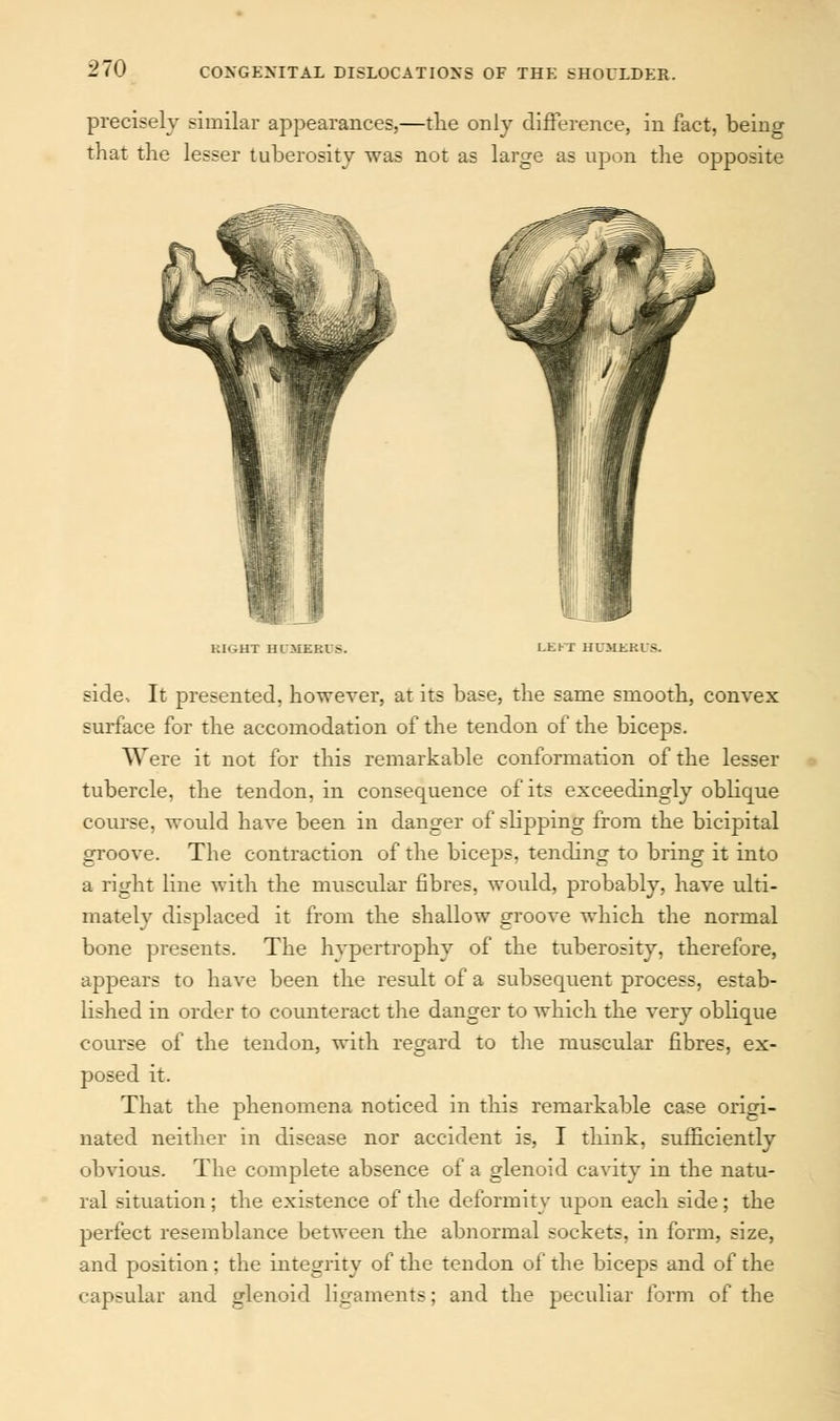 precisely similar appearances,—the only difference, in fact, being that the lesser tuberosity was not as large as upon the opposite KiGHT humerus. LEFT HUMERUS. side. It presented, however, at its base, the same smooth, convex surface for the accomodation of the tendon of the biceps. Were it not for this remarkable conformation of the lesser tubercle, the tendon, in consequence of its exceedingly oblique course, would have been in danger of slipping from the bicipital groove. The contraction of the biceps, tending to bring it into a right line with the muscular fibres, would, probably, have ulti- mately displaced it from the shallow groove which the normal bone presents. The hypertrophy of the tuberosity, therefore, appears to have been the result of a subsequent process, estab- lished in order to counteract the danger to which the very oblique course of the tendon, with regard to the muscular fibres, ex- posed it. That the phenomena noticed in this remarkable case origi- nated neither in disease nor accident is, I think, sufficiently obvious. The complete absence of a glenoid cavity in the natu- ral situation; the existence of the deformity upon each side; the perfect resemblance between the abnormal sockets, in form, size, and position; the integrity of the tendon of the biceps and of the capsular and glenoid ligaments; and the peculiar form of the