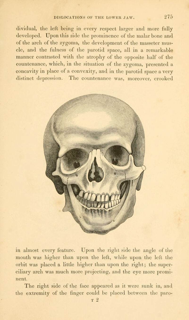 dividual, the left being in every respect larger and more fully developed. Upon this side the prominence of the malar bone and of the arch of the zygoma, the development of the massctcr mus- cle, and the fulness of the parotid space, all in a remarkable manner contrasted with the atrophy of the opposite half of the countenance, which, in the situation of the zygoma, presented a concavity in place of a convexity, and in the parotid space a very distinct depression. The countenance was, moreover, crooked in almost every feature. Upon the right side the angle of the mouth was higher than upon the left, while upon the left the orbit was placed a little higher than upon the right; the super- ciliary arch was much more projecting, and the eye more promi- nent. The right side of the face appeared as it were sunk in, and the extremity of the finger could be placed between the paro- r 2