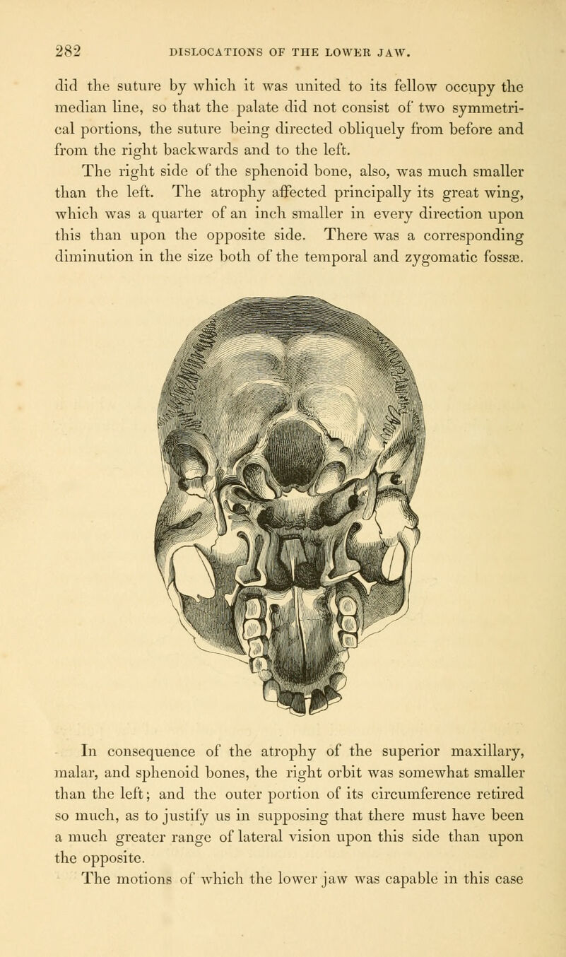 did the suture by which it was united to its fellow occupy the median line, so that the palate did not consist of two symmetri- cal portions, the suture being directed obliquely from before and from the right backwards and to the left. The right side of the sphenoid bone, also, was much smaller than the left. The atrophy affected principally its great wing, which was a quarter of an inch smaller in every direction upon this than upon the opposite side. There was a corresponding diminution in the size both of the temporal and zygomatic fossas. In consequence of the atrophy of the superior maxillary, malar, and sphenoid bones, the right orbit was somewhat smaller than the left; and the outer portion of its circumference retired so much, as to justify us in supposing that there must have been a much greater range of lateral vision upon this side than upon the opposite. The motions of which the lower jaw was capable in this case