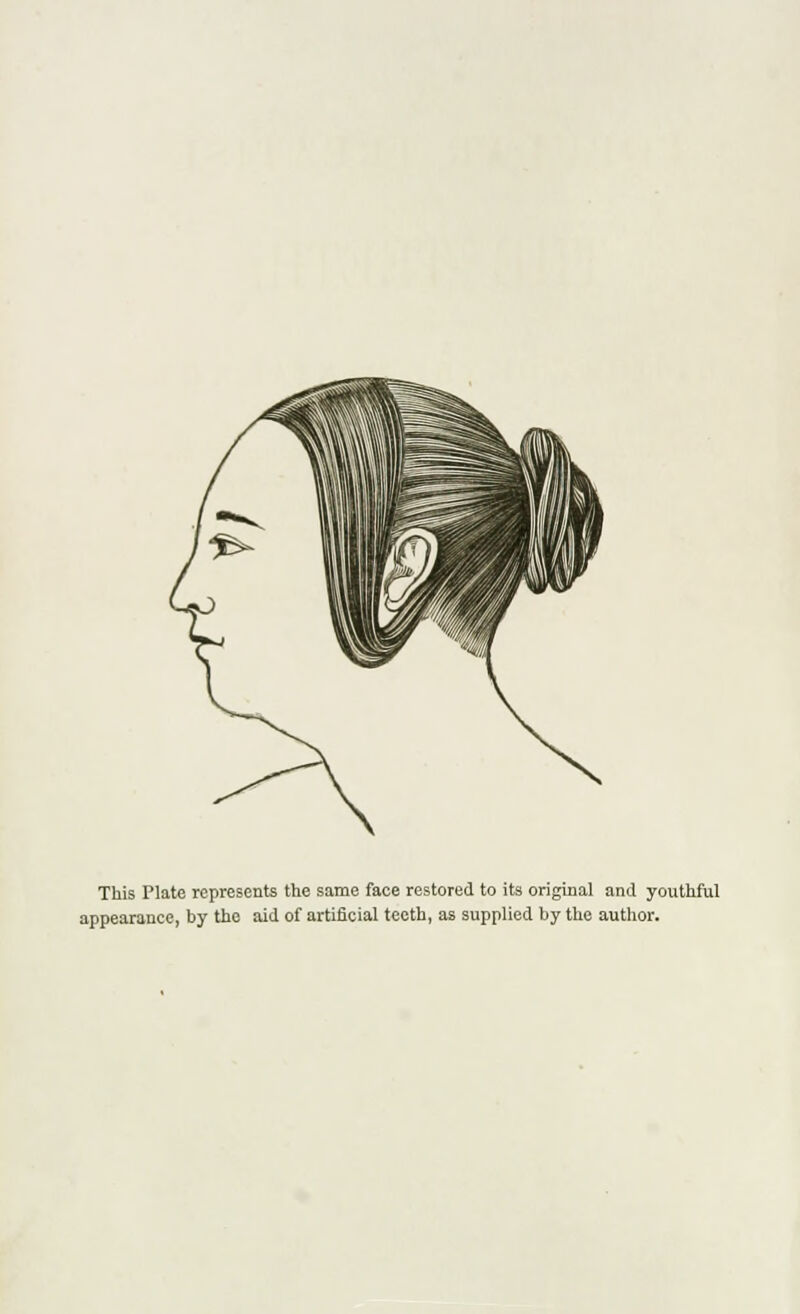 This Plate represents the same face restored to its original and youthful appearance, by the aid of artificial teeth, as supplied by the author.