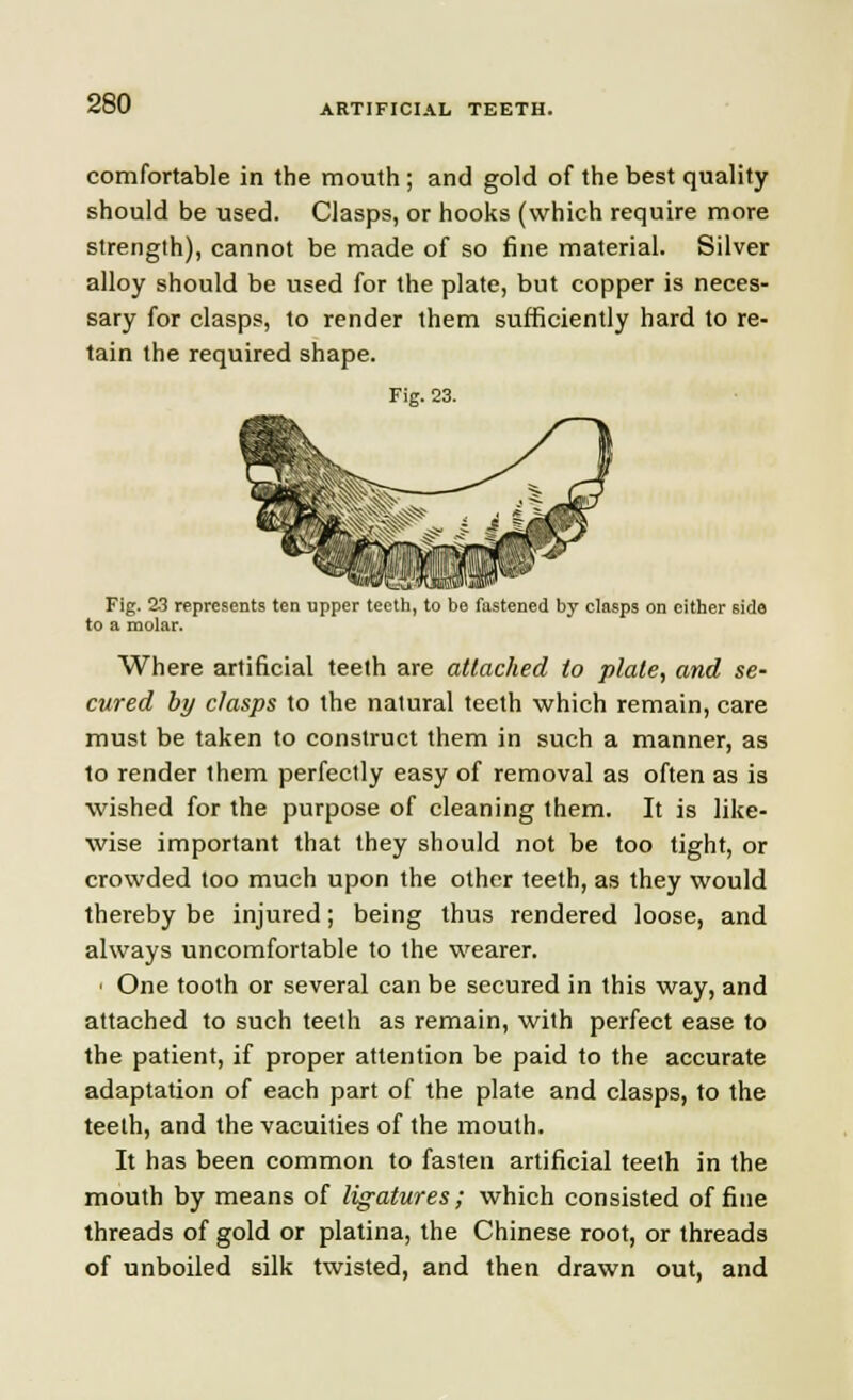 comfortable in the mouth ; and gold of the best quality should be used. Clasps, or hooks (which require more strength), cannot be made of so fine material. Silver alloy should be used for the plate, but copper is neces- sary for clasps, to render them sufficiently hard to re- tain the required shape. Fig. 23. Fig. 23 represents ten upper teeth, to be fastened by clasps on cither side to a molar. Where artificial teeth are attached to plate, and se- cured by clasps to the natural teeth which remain, care must be taken to construct them in such a manner, as to render them perfectly easy of removal as often as is wished for the purpose of cleaning them. It is like- wise important that they should not be too tight, or crowded too much upon the other teeth, as they would thereby be injured; being thus rendered loose, and always uncomfortable to the wearer. • One tooth or several can be secured in this way, and attached to such teeth as remain, with perfect ease to the patient, if proper attention be paid to the accurate adaptation of each part of the plate and clasps, to the teelh, and the vacuities of the mouth. It has been common to fasten artificial teeth in the mouth by means of ligatures; which consisted of fine threads of gold or platina, the Chinese root, or threads of unboiled silk twisted, and then drawn out, and