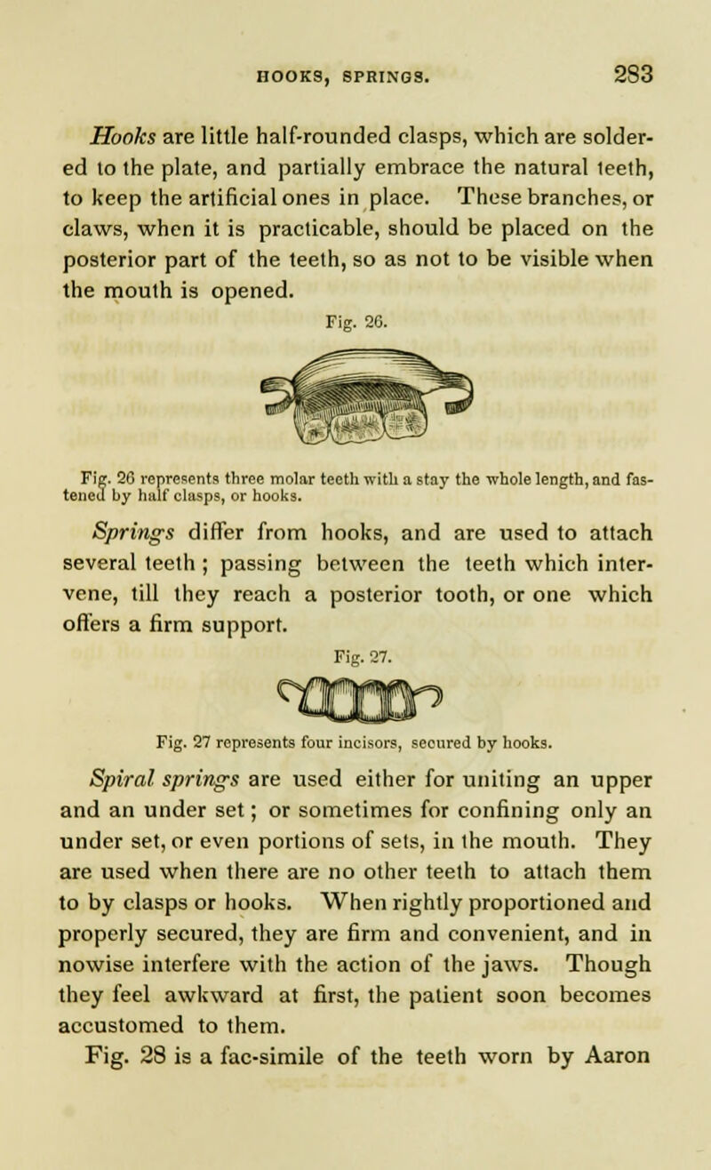 Hooks are little half-rounded clasps, which are solder- ed to the plate, and partially embrace the natural teeth, to keep the artificial ones in place. These branches, or claws, when it is practicable, should be placed on the posterior part of the teeth, so as not to be visible when the mouth is opened. Fig. 20. Fig. 20 represents three molar teeth with a stay the whole length, and fas- tened by half clasps, or hooks. Springs differ from hooks, and are used to attach several teeth ; passing between the teeth which inter- vene, till they reach a posterior tooth, or one which offers a firm support. Fig. 27. Fig. 27 represents four incisors, secured by hooks. Spiral springs are used either for uniting an upper and an under set; or sometimes for confining only an under set, or even portions of sets, in the mouth. They are used when there are no other teeth to attach them to by clasps or hooks. When rightly proportioned and properly secured, they are firm and convenient, and in nowise interfere with the action of the jaws. Though they feel awkward at first, the patient soon becomes accustomed to them. Fig. 28 is a fac-simile of the teeth worn by Aaron