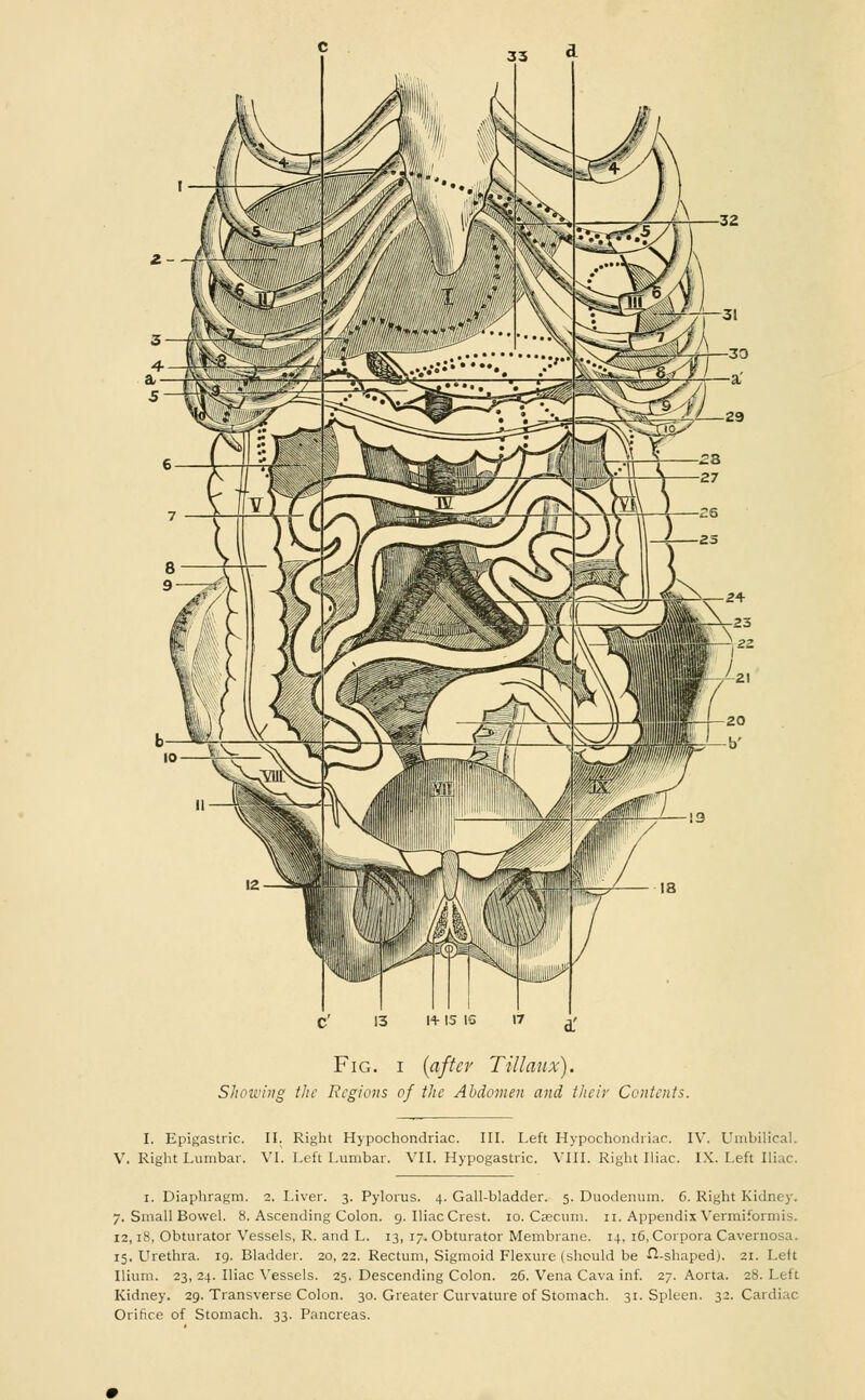 Fig. i (after Till mix). Showing the Regions of the Abdomen and their Contents. I. Epigastric. II. Right Hypochondriac. III. Left Hypochondriac. IV. Umbilical V. Right Lumbar. VI. Left Lumbar. VII. Hypogastric. VIII. Right Iliac. IX. Left Iliac. i. Diaphragm. 2. Liver. 3. Pylorus. 4. Gall-bladder. 5. Duodenum. 6. Right Kidney. 7. Small Bowel. 8. Ascending Colon. 9. IliacCrest. 10. Caecum. 11. Appendix Vermiformis. 12,18, Obturator Vessels, R. and L. 13, 17. Obturator Membrane. 14, 16, Corpora Cavernosa. 15. Urethra. 19. Bladder. 20,22. Rectum, Sigmoid Flexure (should be ^-shaped). 21. Left Ilium. 23, 24. Iliac Vessels. 25. Descending Colon. 26. Vena Cava inf. 27. Aorta. 28. Left Kidney. 29. Transverse Colon. 30. Greater Curvature of Stomach. 31. Spleen. 32. Cardiac Orifice of Stomach. 33. Pancreas.