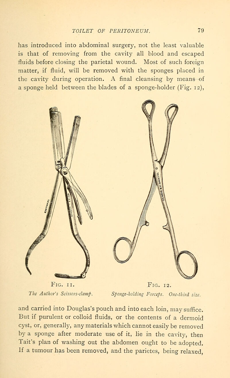 has introduced into abdominal surgery, not the least valuable is that of removing from the cavity all blood and escaped fluids before closing the parietal wound. Most of such foreign matter, if fluid, will be removed with the sponges placed in the cavity during operation. A final cleansing by means of a sponge held between the blades of a sponge-holder (Fig. 12), Fig. 11. The Author's Scissors-clamp. Fig. 12. Sponge-holding Forceps. One-third size. and carried into Douglas's pouch and into each loin, ma}'suffice. But if purulent or colloid fluids, or the contents of a dermoid cyst, or, generally, any materials which cannot easily be removed by a sponge after moderate use of it, lie in the cavity, then Tait's plan of washing out the abdomen ought to be adopted. If a tumour has been removed, and the parietes, being relaxed