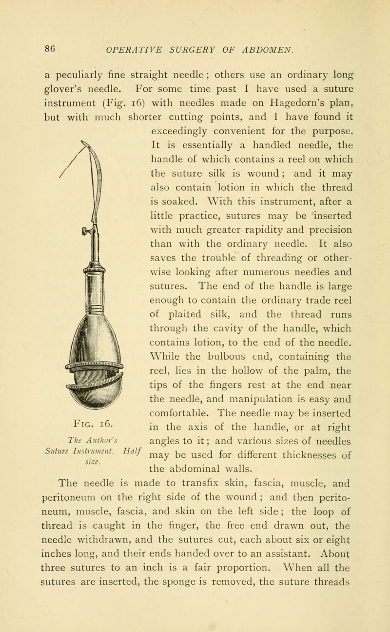 a peculiarly fine straight needle ; others use an ordinary long glover's needle. For some time past I have used a suture instrument (Fig. 16) with needles made on Hagedorn's plan, but with much shorter cutting points, and I have found it exceedingly convenient for the purpose. It is essentially a handled needle, the handle of which contains a reel on which the suture silk is wound ; and it may also contain lotion in which the thread is soaked. With this instrument, after a little practice, sutures may be inserted with much greater rapidity and precision than with the ordinary needle. It also saves the trouble of threading or other- wise looking after numerous needles and sutures. The end of the handle is large enough to contain the ordinary trade reel of plaited silk, and the thread runs through the cavity of the handle, which contains lotion, to the end of the needle. While the bulbous end, containing the reel, lies in the hollow of the palm, the tips of the fingers rest at the end near the needle, and manipulation is easy and comfortable. The needle may be inserted in the axis of the handle, or at right angles to it; and various sizes of needles Hali may be used for different thicknesses of size. the abdominal walls. The needle is made to transfix skin, fascia, muscle, and peritoneum on the right side of the wound ; and then perito- neum, muscle, fascia, and skin on the left side ; the loop of thread is caught in the finger, the free end drawn out, the needle withdrawn, and the sutures cut, each about six or eight inches long, and their ends handed over to an assistant. About three sutures to an inch is a fair proportion. When all the sutures are inserted, the sponge is removed, the suture threads Fig. 16. The Author's