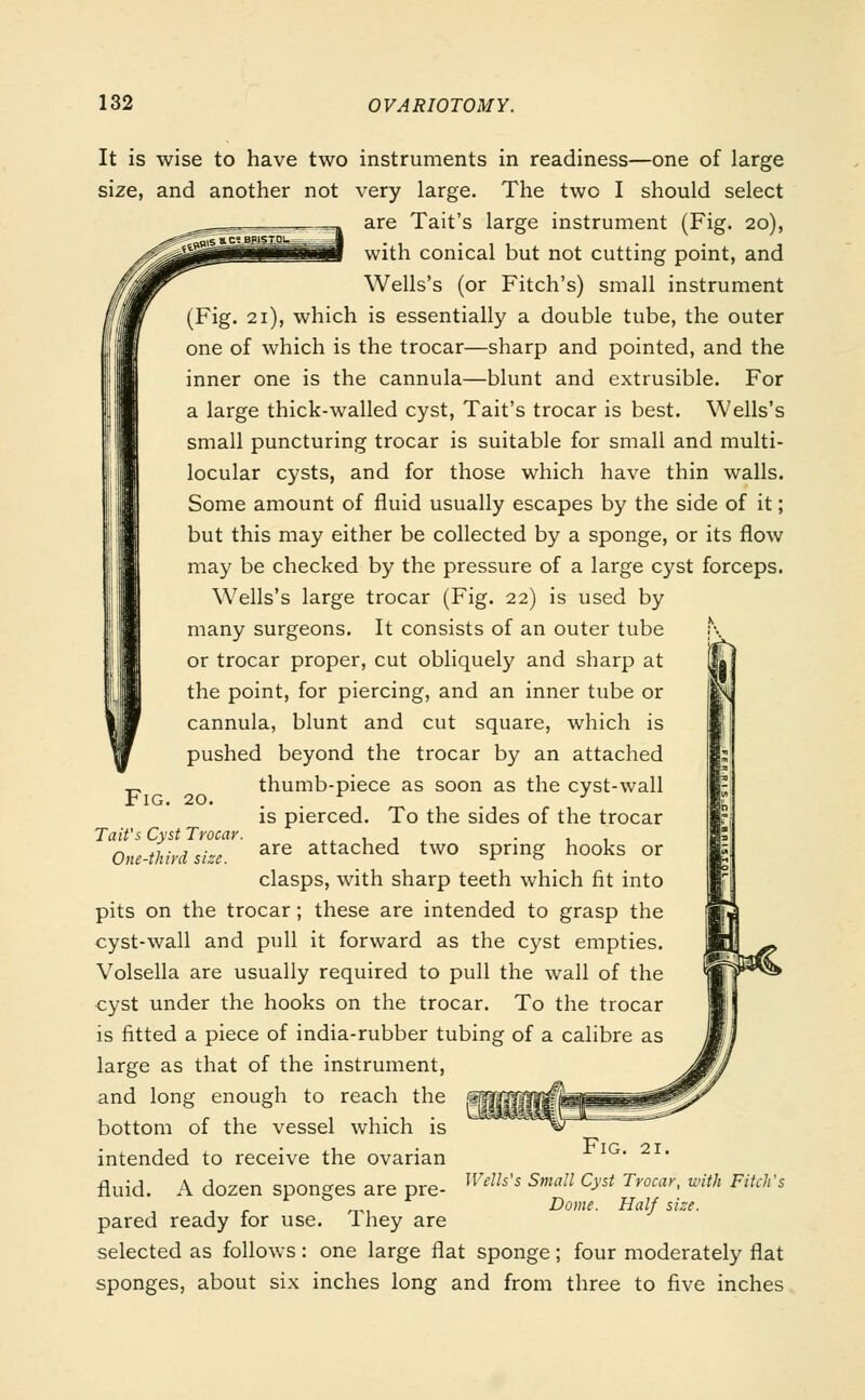 It is wise to have two instruments in readiness—one of large size, and another not very large. The two I should select are Tait's large instrument (Fig. 20), with conical but not cutting point, and Wells's (or Fitch's) small instrument (Fig. 21), which is essentially a double tube, the outer one of which is the trocar—sharp and pointed, and the inner one is the cannula—blunt and extrusible. For a large thick-walled cyst, Tait's trocar is best. Wells's small puncturing trocar is suitable for small and multi- locular cysts, and for those which have thin walls. Some amount of fluid usually escapes by the side of it; but this may either be collected by a sponge, or its flow may be checked by the pressure of a large cyst forceps. Wells's large trocar (Fig. 22) is used by many surgeons. It consists of an outer tube ;\ or trocar proper, cut obliquely and sharp at the point, for piercing, and an inner tube or cannula, blunt and cut square, which is pushed beyond the trocar by an attached thumb-piece as soon as the cyst-wall is pierced. To the sides of the trocar are attached two spring hooks or clasps, with sharp teeth which fit into pits on the trocar; these are intended to grasp the cyst-wall and pull it forward as the cyst empties. Volsella are usually required to pull the wall of the cyst under the hooks on the trocar. To the trocar is fitted a piece of india-rubber tubing of a calibre as large as that of the instrument, and long enough to reach the bottom of the vessel which is intended to receive the ovarian fluid. A dozen sponges are pre- pared ready for use. They are selected as follows: one large flat sponge; four moderately flat sponges, about six inches long and from three to five inches Fig. 20. Tait's Cyst Trocar One-third size. Fig. 21. Wells's Small Cyst Trocar, with Fitch's Dome. Half size.