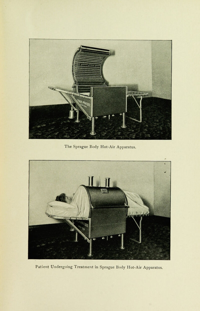 nOKnlsli hBhB mm The Sprague Body Hot-Air Apparatus. Patient Undergoing Treatment in Sprague Body Hot-Air Apparatus.