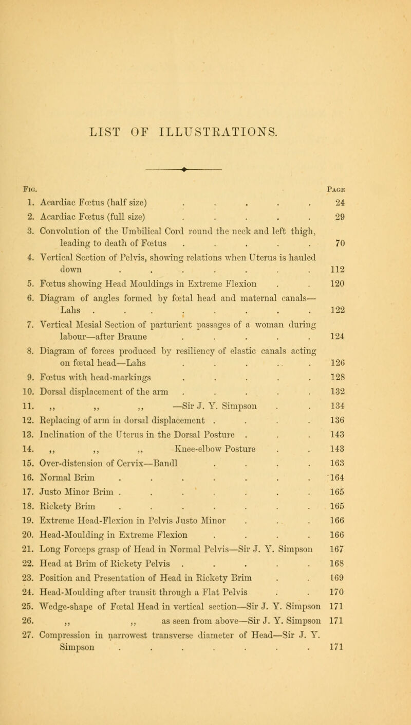 Fig. Page 1. Acardiac Foetus (half size) ..... 24 2. Acardiac Foetus (full size) ..... 29 3. Convolution of the Umbilical Cord round the neck and left thigh, leading to death of Foetus ..... 70 4. Vertical Section of Pelvis, showing relations when Uterus is hauled down ....... 112 5. Foetus showing Head Mouldings in Extreme Flexion . . 120 6. Diagram of angles formed by foetal head and maternal canals— Lahs . ... . . .122 7. Vertical Mesial Section of parturient passages of a woman during labour—after Braune . . . . .124 8. Diagram of forces produced by resiliency of elastic canals acting on foetal head—Lahs . . . .. .126 9. Foetus with head-markings . . . . .128 10. Dorsal displacement of the arm ..... 132 11. ,, ,, ,, —Sir J. Y. Simpson . . 134 12. Replacing of arm in dorsal displacement .... 136 13. Inclination of the Uterus in the Dorsal Posture . . . 143 14. ,, ,, ,, Knee-elbow Posture . . 143 15. Over-distension of Cervix—Bandl . . 163 164 165 165 166 166 16. Normal Brim .... 17. Justo Minor Brim .... 18. Rickety Brim .... 19. Extreme Head-Flexion in Pelvis Justo Minor 20. Head-Moulding in Extreme Flexion 21. Long Forceps grasp of Head in Normal Pelvis—Sir J. Y. Simpson 167 22. Head at Brim of Rickety Pelvis . . . . .168 23. Position and Presentation of Head in Rickety Brim . . 169 24. Head-Moulding after transit through a Flat Pelvis . . 170 25. Wedge-shape of Fcetal Head in vertical section—Sir J. Y. Simpson 171 26. „ „ as seen from above—Sir J. Y. Simpson 171 27. Compression in narrowest transverse diameter of Head—Sir J. Y. Simpson . . . . . . .171