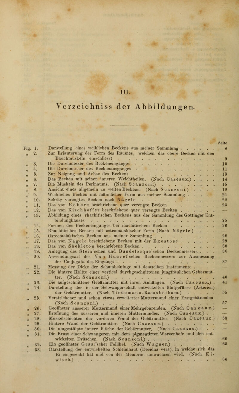 Verzeichniss der Abbildungen. Fig. 1. 2. 3. ?» 4. 5. •n 6. 7. 8. >5 9. 10. 11. 12. « 13. 14. 15. 16. 17. 18. J» 19. 20. »» 21. 22. 23. » 24. » 25. »> 86, 27. „ 28. ?» 29, 30, 31. Darstellung eines weiblichen Beckens aus meiner Sammlung 8 Zur Erläuterung der Form des Raumes, -welchen das obere Becken mit den Bauchmuskeln einschliesst . 9 Die Durchmesser des Beckeneinganges 10 Die Durchmesser des Beckenausganges 11 Zur Neigung und Achse des Beckens 13 Das Becken mit seinen inneren Weichtheilen. (Nach Cazeaux.). . . . 14 Die Muskeln des Perinäums. (Nach Scanzoni.) . 16 Ansicht eines allgemein zu weiten Beckens. (Nach Scanzoni.) . . . . 18 Weibliches Becken mit männlicher Form aus meiner Sammlung 21 Schräg verengtes Becken nach Nägele 22 Das von Robert beschriebene quer verengte Becken . 23 Das von Kirch ho ff er beschriebene quer verengte Becken — Abbildung eines rhachitischen Beckens aus der Sammlung des Göttinger Ent- bindunghauses 25 Formen des Beckeneinganges bei rhachitischem Becken 2G Rhachitisches Becken mit osteomalakischer Form (Nach Nägele) . . . — Osteomalakisches Becken aus meiner Sammlung 28 Das von Nägele beschriebene Becken mit der Exostose 29 Das von Shekleton beschriebene Becken 30 Anlegung des Stein'schen und Baudelocque'schen Beckenmessers ... 36 Anwendungsart des Van Huevel'schen Beckenmessers zur Ausmessung der Conjugata des Eingangs 37 Messung der Dicke der Schambeinfuge mit demselben Instrumente .... — Die hintere Hälfte einer vertical durchgeschnittenen jungfräulichen Gebärmut- ter. (Nach Scanzoni.) 40 Die aufgeschnittene Gebärmutter mit ihren Anhängen. (Nach Cazeaux.) . 41 Darstellung der in der Schwangerschaft entwickelten Blutgefässe (Arterien) der Gebärmutter. (Nach Tiedemann-Rams bo tham.) 55 Verstrichener und schon etwas erweiterter Muttermund einer Erstgebärenden (Nach Scanzoni.) 57 Geöffneter äusserer Muttermund einer Mehrgebärenden. (Nach C a z e a u x.) — Eröffnung des äusseren und inneren Muttermundes. (Nach Cazeaux.) . . — Muskelschichtcn der vorderen Wand der Gebärmutter. (Nach Cazeaux.) 58 Hintere Wand der Gebärmutter. (Nach Cazeaux.) — Die umgestülpte innere Fläche der Gebärmutter. (Nach Cazeaux.) • . . — Die Brust einer Schwangeren mit dem pigmentirten Warzenhofe und den ent- wickelten Drüschen (Nach Scanzoni.) 60 32. Ein geöffneter Graafscher Follikel. (Nach Wagner.) 65 33. Darstellung der entwickelten Schleimhaut (Decidua vera), in welche sich das Ei eingesenkt hat und von der Membran umwachsen wird. (Nach Ki- wi seh.) 66