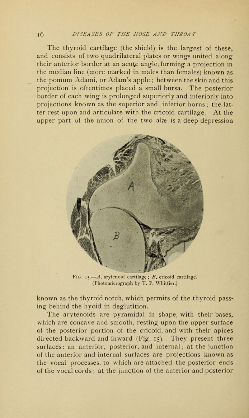 The thyroid cartilage (the shield) is the largest of these, and consists of two quadrilateral plates or wings united along their anterior border at an acute angle, forming a projection in the median line (more marked in males than females) known as the pomum Adami, or Adam's apple ; between the skin and this projection is oftentimes placed a small bursa. The posterior border of each wing is prolonged superiorly and inferiorly into projections known as the superior and inferior horns ; the lat- ter rest upon and articulate with the cricoid cartilage. At the upper part of the union of the two alas is a deep depression Fig. 15.—A, arytenoid cartilage; B, cricoid cartilage. (Photomicrograph by T. P. Whittier.) known as the thyroid notch, which permits of the thyroid pass- ing behind the hyoid in deglutition. The arytenoids are pyramidal in shape, with their bases, which are concave and smooth, resting upon the upper surface of the posterior portion of the cricoid, and with their apices directed backward and inward (Fig. 15). They present three surfaces: an anterior, posterior, and internal; at the junction of the anterior and internal surfaces are projections known as the vocal processes, to which are attached the posterior ends of the vocal cords ; at the junction of the anterior and posterior