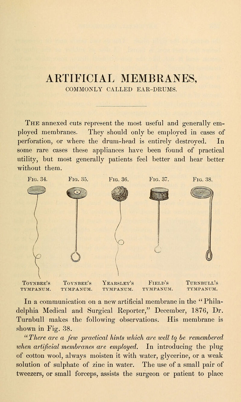 COMMONLY CALLED EAR-DRUMS. The annexed cuts represent the most useful and generally em- ployed membranes. They should only be employed in cases of perforation, or where the drum-head is entirely destroyed. In some rare cases these appliances have been found of practical utility, but most generally patients feel better and hear better without them. Fig. 34. Fig. 35. Fig. 36. Fig. 37. Fig. 38. Toynbee's Toynbee's Yearsley's Field's Turnbull's tympanum. tympanum. tympanum. tympanum. tympanum. In a communication on a new artificial membrane in the Phila- delphia Medical and Surgical Reporter, December, 1876, Dr. Turnbull makes the following observations. His membrane is shown in Fig. 38. There are a few practical hints which are well to be remembered when artificial membranes are employed. In introducing the plug of cotton wool, always moisten it with water, glycerine, or a weak solution of sulphate of zinc in water. The use of a small pair of tweezers, or small forceps, assists the surgeon or patient to place