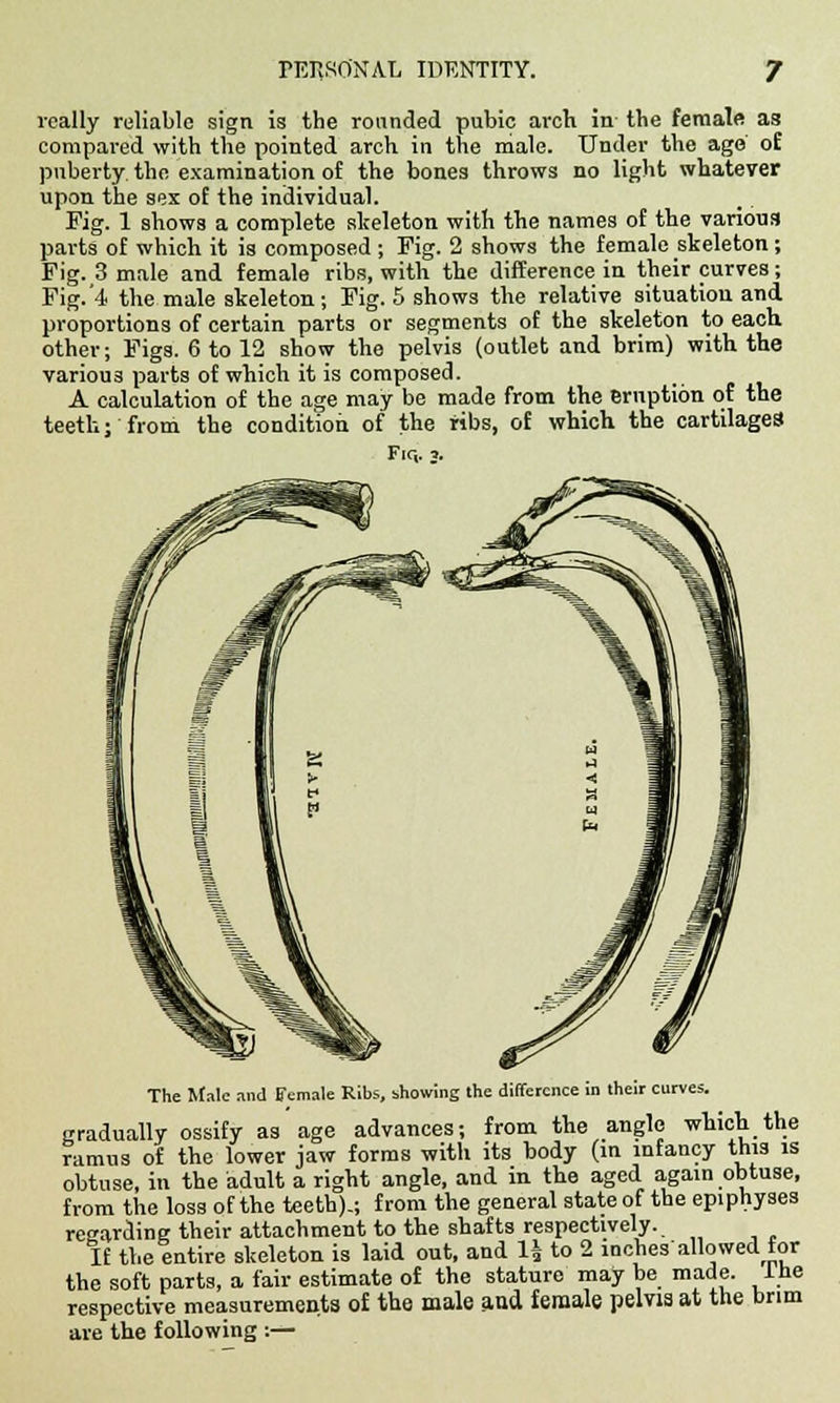 really reliable sign is the rounded pubic arch in the female as compared with the pointed arch in the male. Under the age oE puberty, the examination of the bones throws no light whatever upon the sex of the individual. Fig. 1 shows a complete skeleton with the names of the various parts of which it is composed; Fig. 2 shows the female skeleton; Fig. 3 male and female ribs, with the difference in their curves; Fig.'4 the male skeleton; Fig. 5 shows the relative situation and proportions of certain parts or segments of the skeleton to each, other; Figs. 6 to 12 show the pelvis (outlet and brim) with the various parts of which it is composed. A calculation of the age may be made from the eruption of the teeth; from the condition of the ribs, of which the cartilages Fir,. 3. The Male and female Ribs, showing the difference in their curves. gradually ossify as age advances; from the angle which the ramus of the lower jaw forms with its body (in infancy this is obtuse, in the adult a right angle, and in the aged again obtuse, from the loss of the teeth).; from the general state of the epiphyses regarding their attachment to the shafts respectively. If the entire skeleton is laid out, and 1| to 2 inches'allowed tor the soft parts, a fair estimate of the stature may be made, the respective measurements of the male and female pelvia at the brim are the following:—