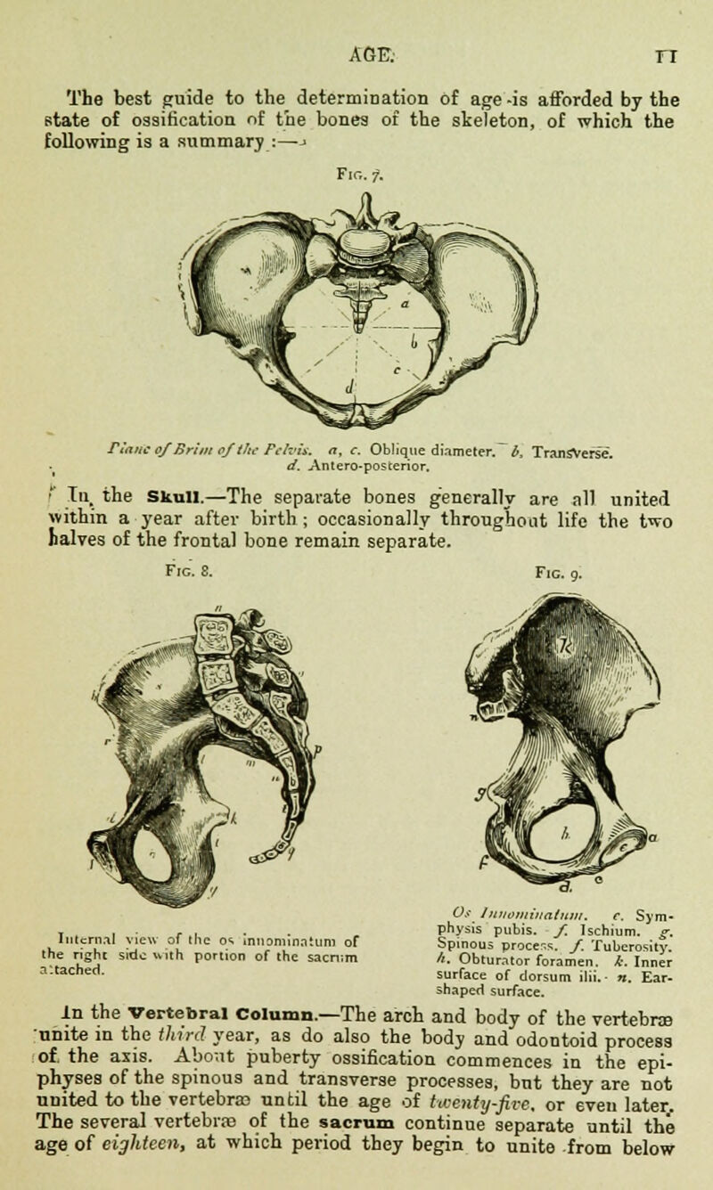 AGF. rc The best guide to the determination of age -is afforded by the state of ossification of the bones of the skeleton, of which the following is a summary :—j Fig. 7. riant 0/Brim ojthe Fefris. at c. Oblique diameter, b. Transverse. d. Antero-posterior. f Tn, the Skull.—The separate bones generally are all united within a year after birth; occasionally throughout life the two halves of the frontal bone remain separate. Fig. 8. Fig. 9. Os Iniwmiuatnin. c. Sym- .... ... . . . physis pubis, f. Ischium, g. Iulcrn.il view of the as .nnominaiun, of Spinous proce-.s. /. Tuberosity, the right side with portion of the sacnim /,. Obturator foramen. *. Inner a'tacned- surface of dorsum ilii. ■ n. Ear- shaped surface. in the Vertebral Column.—The arch and body of the vertebra unite in the third year, as do also the body and odontoid process of. the axis. About puberty ossification commences in the epi- physes of the spinous and transverse processes, but they are not united to the vertebra? until the age of twenty-five, or even later. The several vertebrre of the sacrum continue separate until the age of eighteen, at which period they begin to unite from below