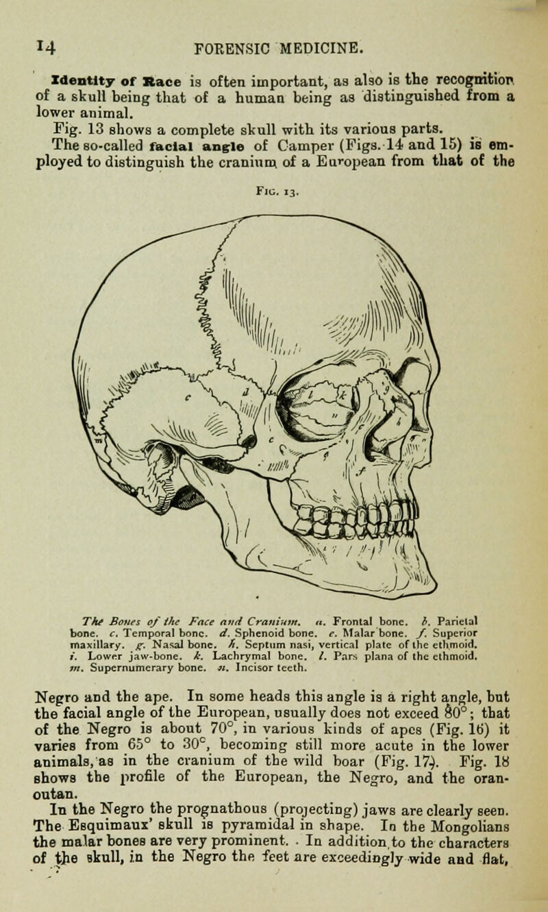 Identity of Race is often important, as also is the recognition of a skull being that of a human being as distinguished from a lower animal. Fig. 13 shows a complete skull with its various parts. The so-called facial angle of Camper (Figs. 14 and 15) is em- ployed to distinguish the cranium of a European from that of the Fig. 13. The Bones of the Face and Cranium, n. Frontal bone, h. Parietal bone. c. Temporal bone. d. Sphenoid bone. e. Malar bone. /. Superior maxillary, f. Nasal bone. h. Septum nasi, vertical plate of the ethmoid. i. Lower jaw-bone. k. Lachrymal bone. /. Pars plana of the ethmoid. m. Supernumerary bone. ». Incisor teeth. Negro aDd the ape. In some heads this angle is a right angle, but the facial angle of the European, usually does not exceed &0°; that of the Negro is about 70°, in various kinds of apes (Fig. 16) it varies from 65° to 30°, becoming still more acute in the lower animals, as in the cranium of the wild boar (Fig. 17.). Fig. lfci shows the profile of the European, the Negro, and the oran- outan. In the Negro the prognathous (projecting) jaws are clearly seeD. The Esquimaux' skull is pyramidal in shape. In the Mongolians the malar bones are very prominent. . In addition.to the characters of the skull, in the Negro the feet are exceedingly wide and flat,