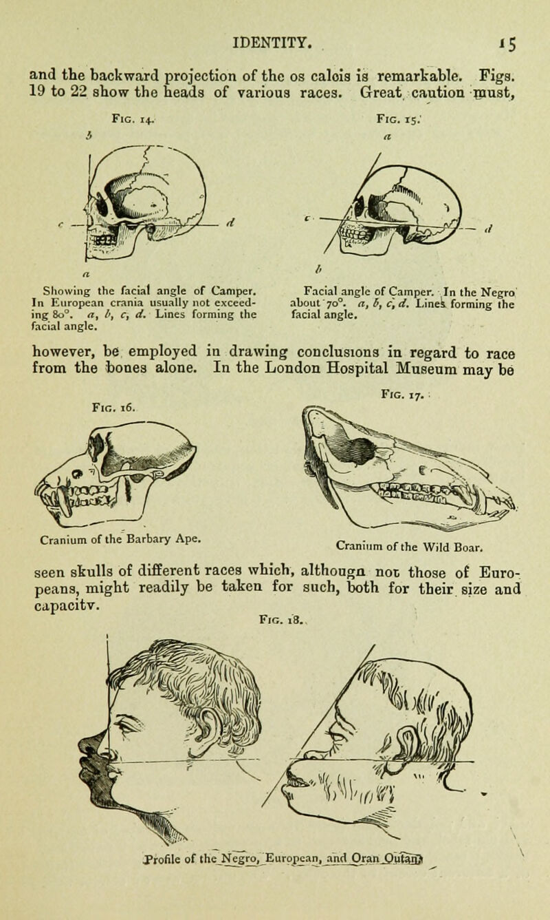 and the backward projection of the os calois is remarkable. Figs. 19 to 22 show the heads of various races. Great caution raust, Fig. 14. Fig. 15: Showing the facial angle of Camper. In European crania usually not exceed- ing 8o°. a, /', c, d. Lines forming the facial angle. Facial angle of Camper. In the Negro ahout7o°. a, 6, c\d. Li nek forming the facial angle. however, be employed in drawing conclusions in regard to race from the bones alone. In the London Hospital Museum may be Fig. 17. Cranium of the Barbary Ape. ^.^ rf ^ ^ ^ seen skulls of different races which, althougn not those of Euro- peans, might readily be taken for such, both for their size and capacity. Fig. 18.. .Profile of the Negro, Europj:an,jmd^rari_S)iltiQ>