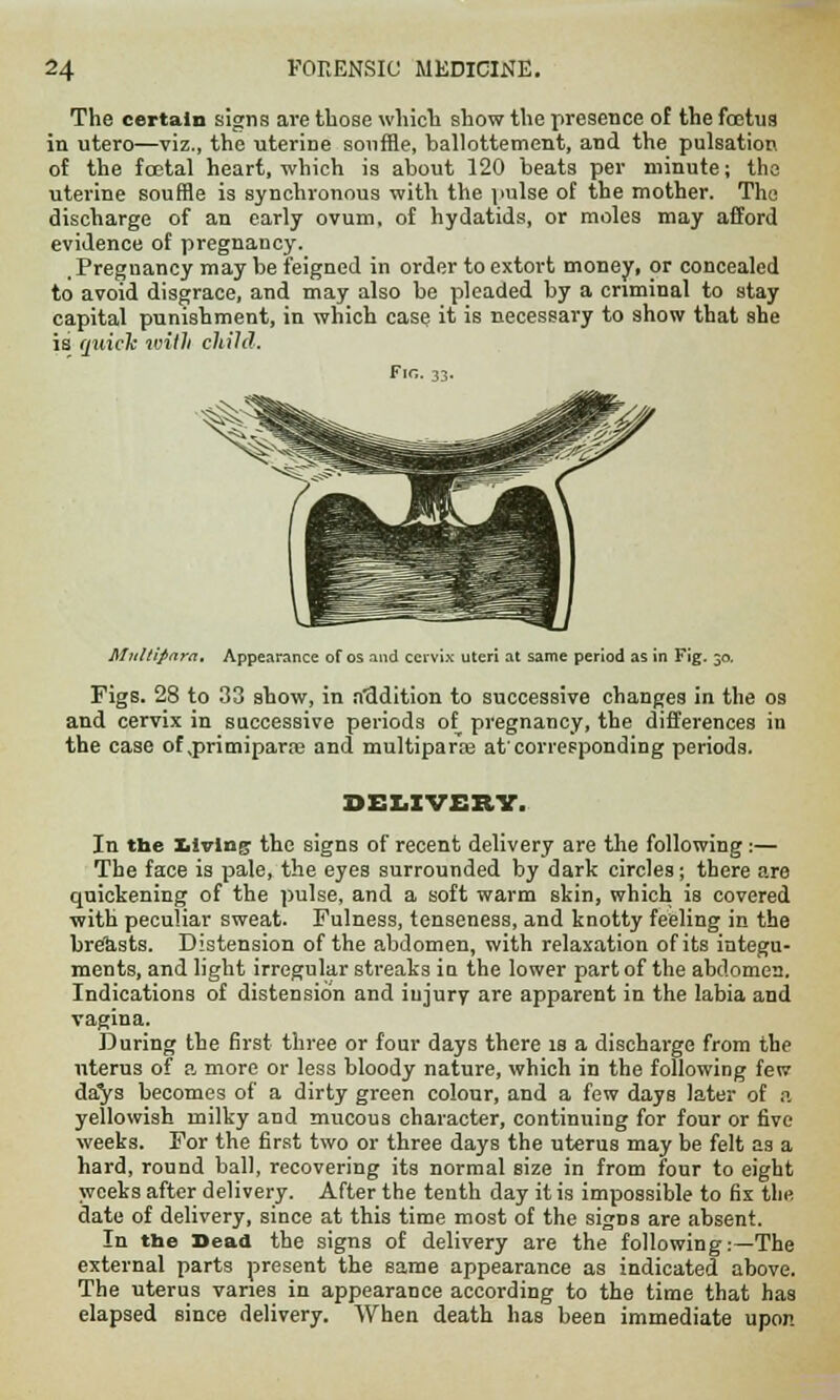 The certain signs are those which show the presence of the foetus in utero—viz., the uterine souffle, ballottement, and the pulsation of the foetal heart, which is about 120 beats per minute; the uterine souffle is synchronous with the pulse of the mother. The discharge of an early ovum, of hydatids, or moles may afford evidence of pregnancy. Pregnancy may be feigned in order to extort money, or concealed to avoid disgrace, and may also be pleaded by a criminal to stay capital punishment, in which case it is necessary to show that she is quick witli child. Fin. 33. Multipara, Appearance of OS and cervix uteri at same period as in Fig. 30. Figs. 28 to 33 show, in addition to successive changes in the os and cervix in successive periods of pregnancy, the differences in the case of ,primipara3 and multiparas at'corresponding periods. DELIVERY. In the living: the signs of recent delivery are the following:— The face is pale, the eyes surrounded by dark circles; there are quickening of the pulse, and a soft warm skin, which is covered with peculiar sweat. Fulness, tenseness, and knotty feeling in the breUsts. Distension of the abdomen, with relaxation of its integu- ments, and light irregular streaks ia the lower part of the abdomen. Indications of distension and injury are apparent in the labia and vagina. During the first three or four days there is a discharge from the uterus of a more or less bloody nature, which in the following few da'ys becomes of a dirty green colour, and a few days later of a yellowish milky and mucous character, continuing for four or five weeks. For the first two or three days the uterus may be felt as a hard, round ball, recovering its normal size in from four to eight weeks after delivery. After the tenth day it is impossible to fix the date of delivery, since at this time most of the signs are absent. In the Dead the signs of delivery are the following.—The external parts present the same appearance as indicated above. The uterus varies in appearance according to the time that has elapsed since delivery. When death has been immediate upon