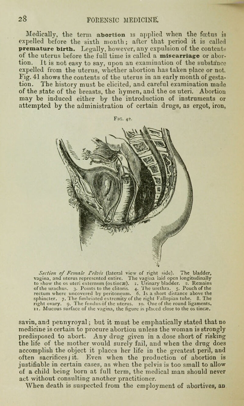 Medically, the term abortion is applied when the foetus is expelled before the sixth mouth; after that period it is called premature blrtb. Legally, however, auy expulsion of the contents of the uterus before the full time is called a miscarriage or abor- tion. It is not easy to say, upon an examination of the substance expelled from the uterus, whether abortion has taken place or not. Fig. 41 shows the contents of the uterus in an early month of gesta- tion. The history must be elicited, and careful examination made of the state of the breasts, the hymen, and the os uteri. Abortion may be induced either by the introduction of instruments or attempted by the administration of certain drugs, as ergot, iron, Fie. 42. Section of Female re/vis (lateral view of right side). The bladder, vagina, and uterus represented entire. The vagina laid open longitudinally to show the os uteri externum (ostincae). 1. Urinary bladder. 2. Remains of the urachus. 3. Pouits to the clitoris. 4. The urethra. 5. Pouch of the rectum where uncovered by peritoneum. 6. Is a short distance above the sphincter. 7. The fimbriated extremity of the right Fallopian tube. 8. The right ovary. 9. The fundus of the uterus. :o. One of the round ligaments. 11. Mucous surface of the vagina, the figure is pbeed close to the os tincx. savin, and pennyroyal; but it must be emphatically stated that no medicine is certain to procure abortion unless the woman is strongly predisposed to abort. Any drug given in a dose short of risking the life of the mother would surely fail, and when the drug does accomplish the object it places her life in the greatest peril, and often sacrifices | it. Even when the production of abortion is justifiable in certain cases, as when the pelvis is too small to allow of a child being born at full term, the medical man should never act without consulting another practitioner. When death is suspected from the employment of abortives, an