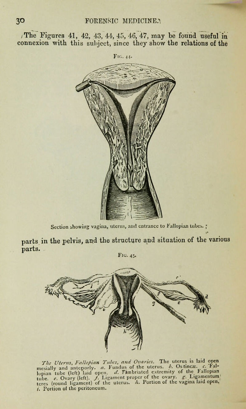 /The Figures 41, 42, .43, 41, 45, 46, 47, may be found useful in connexion with this subject, since they show the relations of the Fie bi- section showing vagina, uterus, and entrance to Fallopian lubes. ; parts in the pelvis, and the structure and situation of the various parts. Flu. 45. The Uterus, Fallopian Tubes, and Ovaries. The uterus is laid open mesially and anteriorly, a. Fundus of the uterus, t. Os linear, c. Fal- lopian tube (left) laid open. d. Fimbriated extremity of the Fallopian tube e Ovary (left). J. Ligament proper of the ovary, g. Ligamentum1 teres (round ligament) of the uterus. /». Portion of the vagina laid open. I. Portion oi the peritoneum.