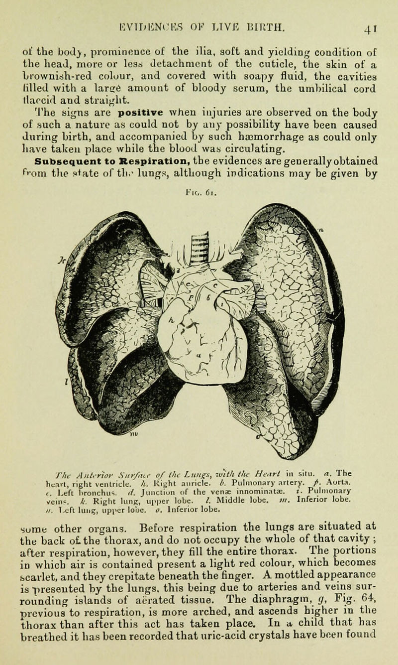 HVlMCNi'KS OF LIVE HlllTH. 4' ol' the body, prominence of the ilia, soft and yielding condition of the head, more or less detachment of the cuticle, the skin of a brownish-red colour, and covered with soapy fluid, the cavities lilled with a larcre amount of bloody serum, the umbilical cord llaccid and straight. The signs are positive when injuries are observed on the body of such a nature as could not by any possibility have been caused during birth, and accompanied by such haemorrhage as could only have taken place while the blood was circulating. Subsequent to Respiration, the evidences are generally obtained from the state of tin- lungs, although indications may be given by Fig. 6i. The Anterior Sur/aie 0/ the Lungs, with the Heart in situ. a. The heart, right ventricle, h. Right auricle, b. Pulmonary artery. /. Aorta. t. Left bronchus, t/. Junction of the venae innominata:. i. Pulmonary vem=. k. Right lung, upper lobe. /. Middle lobe. m. Inferior lobe. //. Left lung, upper lobe. o. Inferior lobe. some other organs. Before respiration the lungs are situated at the back of. the thorax, and do not occupy the whole of that cavity ; after respiration, however, they fill the entire thorax. The portions in which air is contained present a light red colour, which becomes scarlet, and they crepitate beneath the finger. A mottled appearance is presented by the lungs, this being due to arteries and veins sur- rounding islands of aerated tissue. The diaphragm, g. Fig. 64, ttrevious to respiration, is more arched, and ascends higher in the thorax than after this act has taken place. In a, child that has breathed it has been recorded that uric-acid crystals have been found