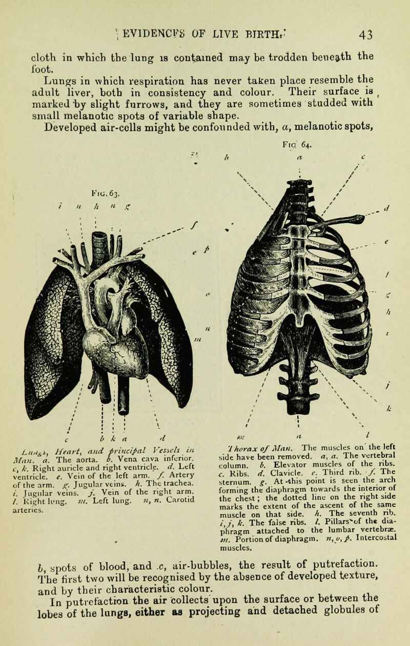 cloth in which the lung is contained may be trodden beneath the loot. Lungs in which respiration has never taken place resemble the adult liver, both in consistency and colour. Their surface is , marked by slight furrows, and they are sometimes studded with small melanotic spots of variable shape. Developed air-cells might be confounded with, a, melanotic spots, Fiq 64. Lit,i&i, Heart, and principal Vessels in Man. a. The aorta, b. Vena cava inferior. c, I. Right auricle and right ventricle, d. Left ventricle, e. Vein of the left arm. / Artery of the arm. g. Jugular veins. /(. The trachea. i. Jugular veins. / Vein of the right arm. /. Right lung. ill. Left lung. n, u. Carotid arteries. 7horax 0/ Man. The muscles on'the left side have been removed, a, a. The vertebral column. b. Elevator muscles of the ribs. c. Ribs. d. Clavicle, c. Third rib. / The sternum, g. At -shis point is seen_ the arch forming the diaphragm towards the interior of the chest; the dotted line on the right side marks the extent of the ascent of the same muscle on that side. h. The seventh nb. /,/', k. The false ribs. /. Pillars^of the dia- phragm attached to the lumbar vertebra;. m. Portion of diaphragm. n,y,p. Intercostal muscles. b, spots of blood, and c, air-bubbles, the result of putrefaction. The first two will be recognised by the absence of developed texture, and by their characteristic colour. In putrefaction the air collects upon the surface or between the lobes of the lungs, either as projecting and detached globules of