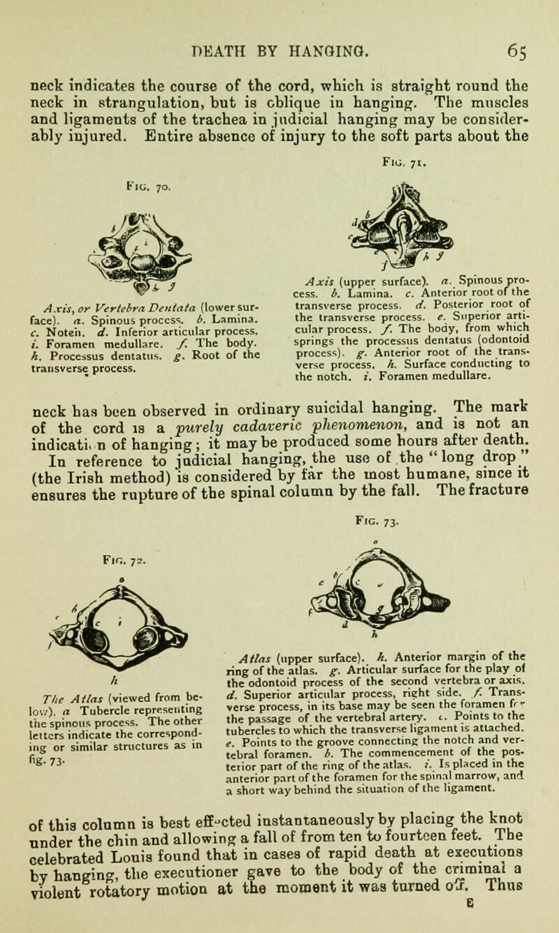 neck indicates the course of the cord, which is straight round the neck in strangulation, but is oblique in hanging. The muscles and ligaments of the trachea in judicial hanging may be consider- ably injured. Entire absence of injury to the soft parts about the Fig. 71. Fig. 70. Axis, or Vertebra BetUata {lower sur- face), a. Spinous process, b. Lamina. c. Noteh. d. Inferior articular process. I. Foramen medullare. f. The body. h. Processus dentatus. g. Root of the transverse process. Axis (upper surface), a. Spinous pro. cess. b. Lamina, c. Anteriorroot of the transverse process, d. Posterior root of the transverse process, e. Superior arti- cular process, f. The body, from which springs the processus dentatus (odontoid process), g. Anterior root of the trans- verse process, k. Surface conducting to the notch. :'. Foramen medullare. neck has been observed in ordinary suicidal hanging. The mark of the cord is a purely cadaveric -phenomenon, and is not an indication of hanging; it maybe produced some hours after death. In reference to judicial hanging, the use of the  long drop (the Irish method) is considered by far the most humane, since it ensures the rupture of the spinal column by the fall. The fracture Fig. 73. Fir.. 72. The Atlas (viewed from be- low), a Tubercle representing the spinous process. The other letters indicate the correspond- ing or similar structures as in fig. 73- Atlas (upper surface), h. Anterior margin of the ring of the atlas, g. Articular surface for the play o( the odontoid process of the second vertebra or axis. d. Superior articular process, right side. /. Trans- verse process, in its base may be seen the foramen fr r the passage of the vertebral artery. 1. Points to the tubercles to which the transverse ligament is attached. e. Points to the groove connecting the notch and ver- tebral foramen, b. The commencement of the pos- teiior part of the ring of the atlas, i. Is placed in the anterior part of the foramen for the spinal marrow, and a short way behind the situation of the ligament. of this column is best effected instantaneously by placing the knot under the chin and allowing a fall of from ten to fourteen feet. The celebrated Louis found that in cases of rapid death at executions by hanging the executioner gave to the body of the criminal a violent rotatory motion at the moment it was turned oj\ Thus