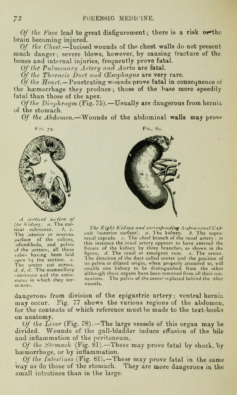 Of the Face lead to great disfigurement; there is a risk ofthe brain becoming injured. Of tlie Chest.—Incised wounds of the chest walls do not present much danger; severe blows, however, by causing fracture of the bones and internal injuries, frequently prove fatal. Of the Pulmonary Artery and Aorta are fatal. Of the Thoracic Duct and (Esophagus are very rare. Of the Heart.—Penetrating wounds prove fatal in consequence oi the haemorrhage they produce; those of the base more speedily fatal than those of the apex. Of tlie Di'tphraym (Fig. 75).—Usually are dangerous from hernia of the stomach. Of the Abdomen.—Wounds of the abdominal walls may prove fir.. Jg. F'C 80. A uerlit til set Unit of the Kidney, it. The cor- tical sub>tancc. fi, c. The interior or mucous surface of the calices, [nfundibula, and pelvis of the ureters, all these tubes having been laid upen by the section, f. The ureter cut across. d, d, d. The mammillary substance and the emin- ences in which they ter- minate. The Right Kidney and coriesfx'ititiitg .Sttfiiit-nntil C<tfi. title 'anterior surface), a. 'I he kidney. b. The supra- renal capsule, e. The chief branch of the renal artery ; in this instance the renal artery appears to have entered the fissure of the kidney by three branches, as shown in the figure, d. The renal or emulgent vein. e. The ureter. 1 he direction of the duct called ureter and the position of its pelvis or dilated origin, when properly attended to, will enable one kidney to be distinguished from the other although these organs have been removed front all their con- nexions. The pelvis of the ureter is placed behind the jthcr vessels. dangerous from division of the epigastric artery, ventral hernia may occur. Fig. 77 shows the various regions of the abdomen, for the contents of which reference must be made to the text-books on anatomy. Of the Liver (Fig. 78).—The large vessels of this organ may be divided. Wounds of the gall-bladder iuduce effusion of the bile and inflammation of the peritoneum. Of the Stomach (Fig. 81).—These may prove fatal by shock, by htemorrhage, or by inflammation. Of the Intestines (Fig. 81).—These may prove fatal in the same way as do those of the stomach. They are more dangerous in the small intestines than in the large.