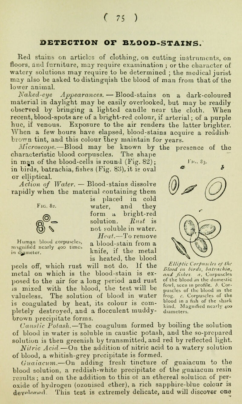 DETECTION Or BLOOD-STAINS. of tlic 83. i Red stains on articles of clothing, on cutting instruments, on floors, and furniture, may require examination ; or the character of watery solutions may require to be determined ; the medical jurist may also be asked to distinguish the blood of man from that of the lower animal. Naked-eye Appearances. — Blood-stains on a dark-coloured material in daylight may be easily overlooked, but may be readily observed by bringing a lighted candle near the cloth. When recent, blood-spots are of a bright-red colour, if arterial; of a purple hue, if veDous. Exposure to the air renders the latter brighter. When a few hours have elapsed, blood-stains acquire a reddish- brown tint, and this colour Ihey maintain for years. Microscope.—Blood may be known by the presence characteristic blood corpuscles. The shape in man of the blood-cells is round (Fig. 82); in birds, batrachia, fishes (Fig. 83), it is oval or elliptical. Action of Water. — Blood-stains dissolve rapidly when the material coutaining them is placed in cold water, and they form a bright-red solution. Rust is not soluble in water. Heat.—To remove a blood-stain from a knife, if the metal is heated, the blood peels off, which rust will not do. If the metal on which is the blood-stain is ex- posed to the air for a long period and rust is mixed with the blood, the test will be valueless. The solution of blood in water is coagulated by heat, its colour is com- pletely destroyed, and a flocculent muddy- brown precipitate forms. Caustic Potash.—The coagulum formed by boiling the solution of blood in water is soluble in caustic potash, and the so-prepared solution is then greenish by transmitted, and red by reflected light. Nitric Acid —On the addition of nitric acid to a watery solution of blood, a whitish-grey precipitate is formed. Guaiacum.—On adding fresh tincture of guaiacum to the blood solution, a reddish-white precipitate of the guaiacum resin results; and on the addition to this ot an ethereal solution of per- oxide of hydrogen (ozonised ether), a rich sapphire-blue colour is devo'o^nd. This test is extremely delicate, and will discover one Fie. 82. Human blood corpuscles, m-ignilied nearly 400 lime; in dimeter. Elliptic Cor/>ust Us oj the Blood m birds, bntracliia, njid fishes, n. Corpuscles of the blood jn the domestic fowl, seen in profile. /-. Cor- puscles of the blood in the frog. c. Corpuscles of the blood in a fish of the shark kind. Magnified nearly 400 diameters.