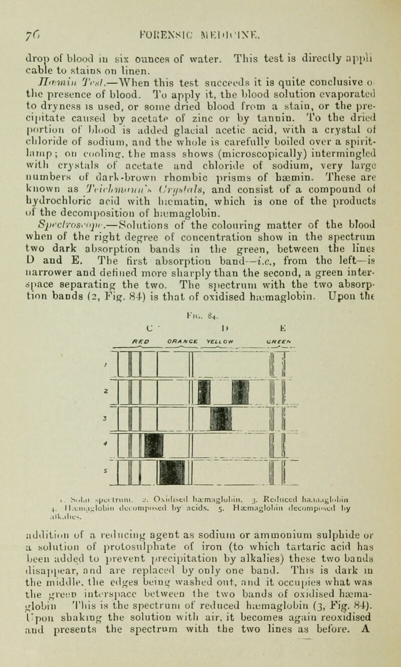 yc Forensic mkmi'ixk. drop of blood iu six ounces of water. This test is directly appli cable to stains on linen. Jlirmin Ti-iil.—When this test succeeds it is quite conclusive o the presence of blood. To apply it, the blood solution evaporated to dryness is used, or some dried blood from a stain, or the pre- cipitate caused by acetate of zinc or by tannin. To the dried portion of blood is added glacial acetic acid, with a crystal of chloride of sodium, and the whole is carefully boiled over a spirit- lamp; on cooling, the mass shows (microscopically) intermingled with crystals of acetate and chloride of sodium, very large numbers of dark-brown rhombic prisms of haemin. These are known as 'J'eichmiiitn'* Uryntnls, and consist of a compound ol hydrochloric acid with lncmatin, which is one of the products of the decomposition of b;omaglobin. Sjjrclrosnipi.— Solutions of the colouring matter of the blood when of the right degree of concentration show in the spectrum two dark absorption bands in the green, between the lines D and E. The first absorption band—i.e., from the left—is narrower and defined more sharply than the second, a green inter- space separating the two. The spectrum with the two absorp- tion bands (2, Fig. 84) is that of oxidised rnumaglobin. Upon th( OAANCE YELLOW E (.V?ffV 1 r 11 to ■17 11 ■ n . Siil.ii spectrum. -•• Oxidised haemagluliin. ;j. Reduced liajaaglohin 1. Il.cm.iulobiii ilueumpnseil tiy acids. 5. Hicma^loltin decompiled l>y alkalies. ' addition of a reducing agent as sodium or ammonium sulphide or a solution of protosulphate of iron (to which tartaric acid has been added to prevent precipitation by alkalies) these two bands disappear, and are replaced by only one band. This is dark m the middle, the edges being washed out, and it occupies what was the green interspace between (he two bands of oxidised hasma- globin This is the spectrum of reduced lnumaglolin (3, Fig. 8-t). f'pou shaking the solution with air, it becomes again reoxidised and presents the spectrum with the two lines as before. A