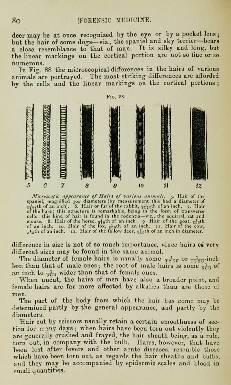 deer may be at once recognized by the eye or by a pocket lens; but the hair of some dogs—viz., the spaniel and sky terrier—bears a close resemblance to that of man. It is silky and long, but the linear markings on the cortical portion are not so fine or so numerous. In Fig. 88 the microscopical differences in the hairs of various animals are portrayed. The most striking differences are afforded by the cells and the linear markings on the cortical portions ; Fie. 88. O (0 1) Microscopic appearance of Hairs of various animals. 5. Hair of the spaniel, magnified 300 diameters (by measurement this had a diameter of y^V^th of an inch). 6. Hair or fur of the rabbit, TTj^th of an inch. 7. Hair of the hare ; this structure is remarkable, being in the form of transverse cells: this kind of hair is found in the rodentia—viz., the squirrel, rat and mouse. 8. Hair of the horse, jioth of an inch 9 Hair of the goat, gjnth of an inch. 10. Hair of the fox, j^th of an inch. 11. Hair of the cow, sJath of an inch. 12. Hair of the fallow deer, ^Jjth of an inch in diameter. difference in size is not of so much importance, since hairs of very different sizes may be found in the same animal. The diameter of female hairs is usually some -r^'jij or Tg'nc-incu leso than that of male ones; the root of male hairs is some -—^ of an inch to yso wider than that of female ones. When uncut, the hairs of men have also a broader point, and female hairs are far more affected by alkalies than are those cf men. The part of the body from which the hair has .come may be determined partly by the general appearance, and partly by the diameters. Hair cut by scissors usually retain a certain smoothness of sec- tion for many days ; when hairs have been torn out violently tboy are generally crushed and frayed, the hair sheath being, as a rule, torn out, in company with the bulb. Hairs, however, that have been lost after fevers and other acute diseases, resemble those which have been torn out, as regards the hair sheaths and bulbs, and they may be accompanied by epidermic scales and blood in email quantities.