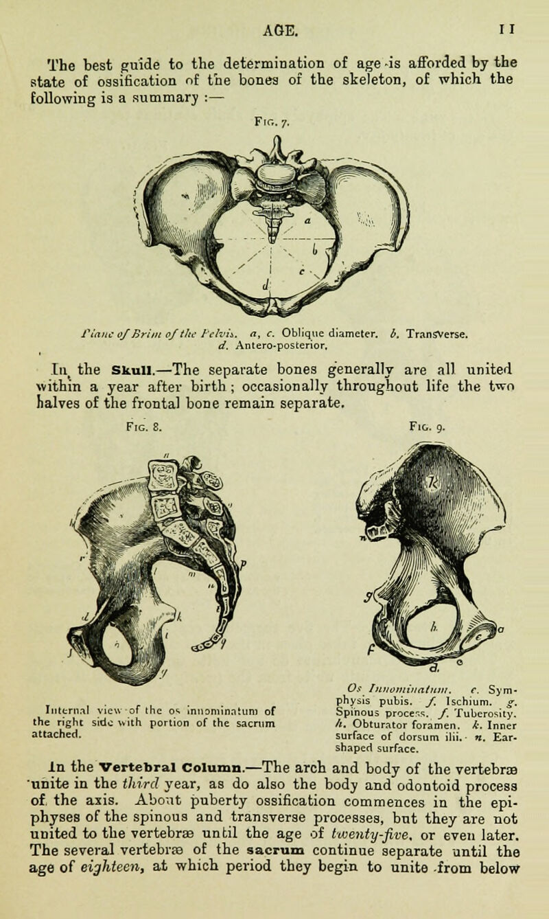 The best guide to the determination of age -is afforded by the state of ossification of the bones of the skeleton, of which the following is a summary :— Fir,. 7. finite 0/ Brim 0/the Pelvh. a, c. Oblique diameter, b. Transverse. d. Antero-posterior. Ill the Skull.—The separate bones generally are all united withm a year after birth ; occasionally throughout life the two halves of the frontal bone remain separate. Fie. 8. Fig. 9. Os IltnomviatHW. e. Sym- . . . . physis pubis. /. Ischium, g. Internal view of the os inn omin.1 turn of Spinous process, f. Tuberosity, the right side with portion of the sacrum h. Obturator foramen, k. Inner attached. surface of dorsum ilii. n. Ear- shaped surface. In the Vertebral Column.—The arch and body of the vertebra unite in the third year, as do also the body and odontoid process of. the axis. About puberty ossification commences in the epi- physes of the spinous and transverse processes, but they are not united to the vertebrae until the age of twenty-Jive, or even later. The several vertebras of the sacrum continue separate until the age of eighteen, at which period they begin to unite from below