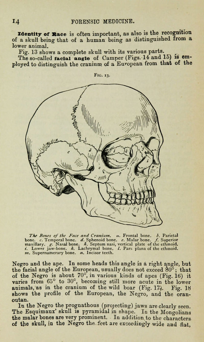 Identity of Race is often important, as also is the recognition of a skull being that of a human being as distinguished from a lower animal. Fig. 13 shows a complete skull with its various parts. The so-called facial angle of Camper (Figs. 14 and 15) is_ em- ployed to distinguish the cranium of a European from that of the Fig. 13. The Bows 0/ the Face and Cranium. «. Frontal bone. b. Parielal bone. c. Temporal bone. d. Sphenoid bone. e. Malar bone. f. Superior maxillary, g. Nasal bone. ft. Septum nasi, vertical plate of the ethmoid. »'. Lower jaw-bone. k. Lachrymal bone. /. Pars plana of the ethmoid. in. Supernumerary bone. «. Incisor teeth. Negro and the ape. In some heads this angle is a right angle, but the facial angle of the European, usually does not exceed §0°; that of the Negro is about 70°, in various kinds of apes (Fig. 16) it varies from 65° to 30°, becoming still more acute in the lower animals, as in the cranium of the wild boar (Fig. V?). Fig. 18 shows the profile of the European, the Negro, and the oran- outan. In the Negro the prognathous (projecting) jaws are clearly seen. The Esquimaux' skull is pyramidal in shape. In the Mongolians the malar bones are very prominent. In addition, to the characters of the skull, in the Negro the feet are exceedingly wide and flat,