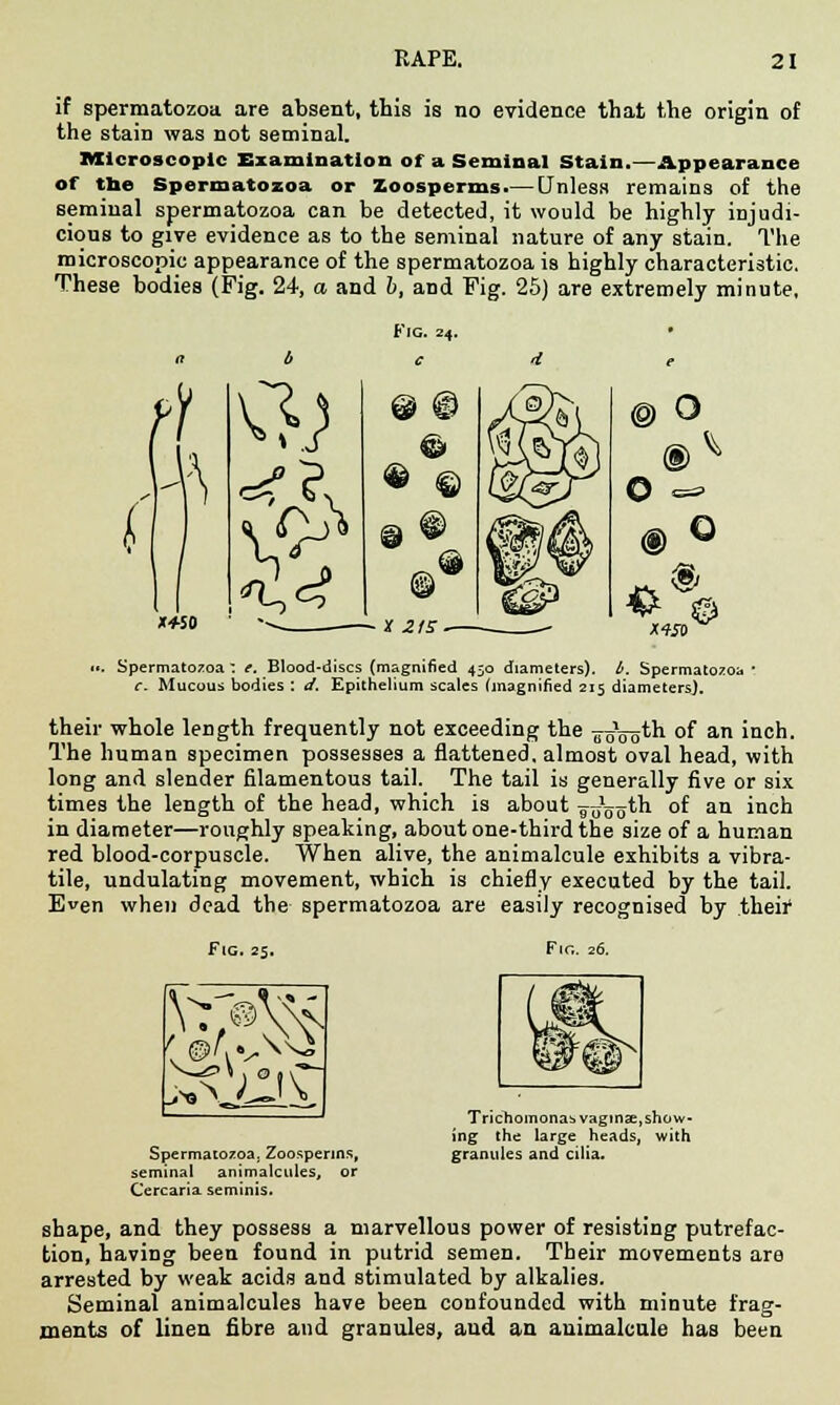 if spermatozoa are absent, this is no evidence that the origin of the stain was not seminal. Microscopic Examination of a Seminal Stain.—Appearance of the Spermatozoa or Zoosperms—Unless remains of the seminal spermatozoa can be detected, it would be highly injudi- cious to give evidence as to the seminal nature of any stain. The microscopic appearance of the spermatozoa is highly characteristic. These bodies (Pig. 24, a and b, and Fig. 25) are extremely minute. Fig. 24. • © o ® ^ ® Q X4S0  ■>. Spermatozoa: t. Blood-discs (magnified 450 diameters), b. Spermatozoa ■ r. Mucous bodies : d. Epithelium scales (magnified 215 diameters). their whole length frequently not exceeding the 77500^ °f an inch. The human specimen possesses a flattened, almost oval head, with long and slender filamentous tail. The tail is generally five or six times the length of the head, which is about ^g^th of an inch in diameter—roughly speaking, about one-third the size of a human red blood-corpuscle. When alive, the animalcule exhibits a vibra- tile, undulating movement, which is chiefly executed by the tail. Even when dead the spermatozoa are easily recognised by their Fig. 25. Fir.. 26. Spermatozoa. Zoosperms, seminal animalcules, or Cercaria seminis. Trichomonas vagtnje, show- ing the large heads, with granules and cilia. shape, and they possess a marvellous power of resisting putrefac- tion, having been found in putrid semen. Their movements are arrested by weak acids and stimulated by alkalies. Seminal animalcules have been confounded with minute frag- ments of linen fibre and granules, and an animalcule has been