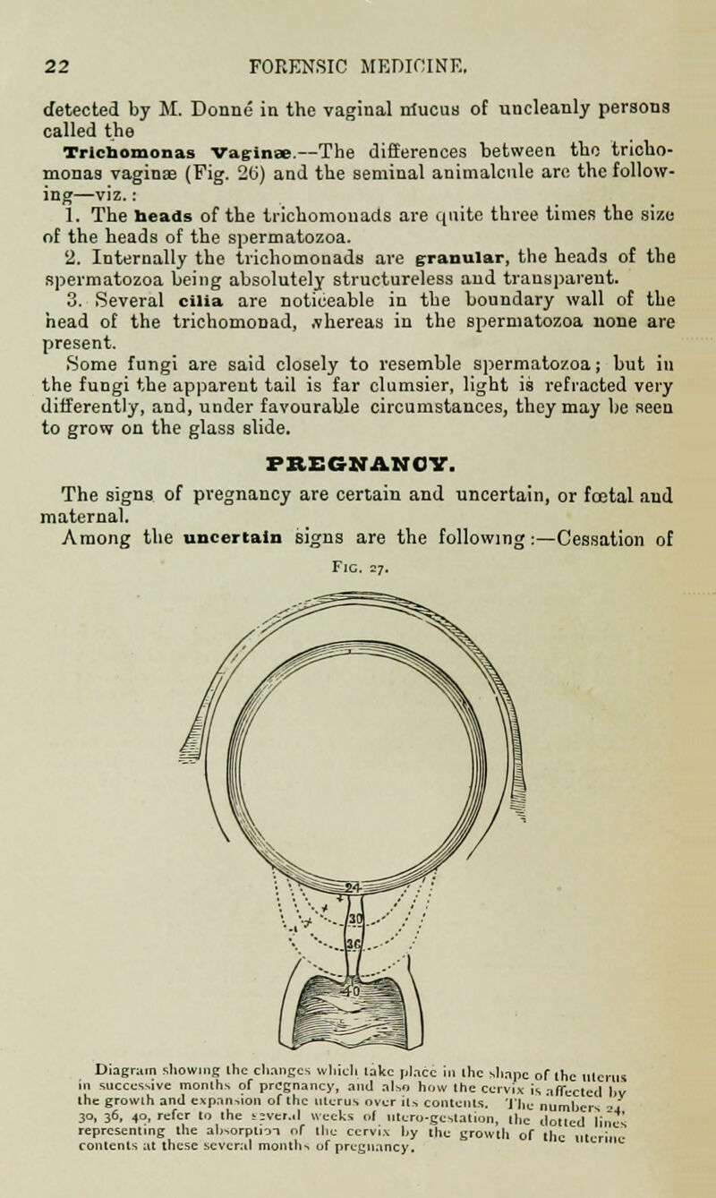 detected by M. Donne in the vaginal nlucus of uncleanly persons called the Trichomonas vagina-—The differences between the tricho- monas vaginae (Fig. 2ti) and the seminal animalcule are the follow- ing—viz.: 1. The heads of the trichomouads are quite three times the size of the heads of the spermatozoa. 2. Internally the trichomonads are granular, the heads of the spermatozoa being absolutely structureless and transparent. 3. Several cilia are noticeable in the boundary wall of the head of the trichomonad, whereas in the spermatozoa none are present. Some fungi are said closely to resemble spermatozoa; but in the fungi the apparent tail is far clumsier, light is refracted very differently, and, under favourable circumstances, they may be seen to grow on the glass slide. PREGNANCY. The signs of pregnancy are certain and uncertain, or fcetal and maternal. Among the uncertain signs are the following:—Cessation of Fig. 27. Diagram showing Ihc changes which lake place in ihc shape of ihe Merits in successive months of pregnancy, and also how Ihe cervix is affected bv the growth and expansion of the uterus over its contents. Tile numbers ~j 30, 36, 40, refer to the sivcr.d weeks of utcro-gestation, the dotted lines representing the absorption of the cervix by the growth of the uterine contents at these several months of pregnancy.