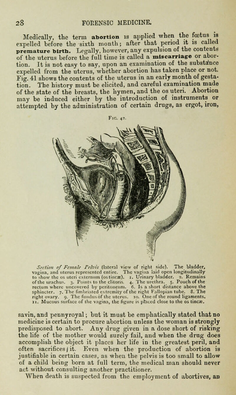 Medically, the term abortion is applied when the foetus is expelled before the sixth month; after that period it is called premature birth. Legally, however, any expulsion of the contents of the uterus before the full time is called a miscarriage or abor- tion. It is not easy to say, upon an examination of the substance expelled from the uterus, whether abortion has taken place or not. Fig. 41 shows the contents of the uterus in an early month of gesta- tion. The history must be elicited, and careful examination made of the state of the breasts, the hymen, and the os uteri. Abortion may be induced either by the introduction of instruments or attempted by the administration of certain drugs, as ergot, iron, Section of Fctnah rrfvis (lateral view of right side). The^ bladder, vagina, and uterus represented entire. The vagina laid open longitudinally to show the os uteri externum (ostinea). I, Urinary bladder. 2. Remains of the urachus. 3. Points to the clitoris. 4. The urethra. _ 5. Pouch of the rectum where uncovered by peritoneum. 6. Is a short distance above the sphincter. 7. 'the fimbriated extremity of the right Fallopian tube. 8. The right ovary. 9. The fundusof the uterus. 10. One of the round ligaments. II. Mucous surface of ttie vagina, the figure is ptaccd close to the os tincae. savin, and pennyroyal; but it must be emphatically stated that no medicine is certain to procure abortion unless the woman is strongly predisposed to abort. Any drug given in a dose short of risking the life of the mother would surely fail, and when the drug does accomplish the object it places her life in the greatest peril, and often sacrifices/it. Even when the production of abortion is justifiable in certain cases, as when the pelvis is too small to allow of a child being born at full term, the medical man should never act without consulting another practitioner. When death is suspected from the employment of abortives, an