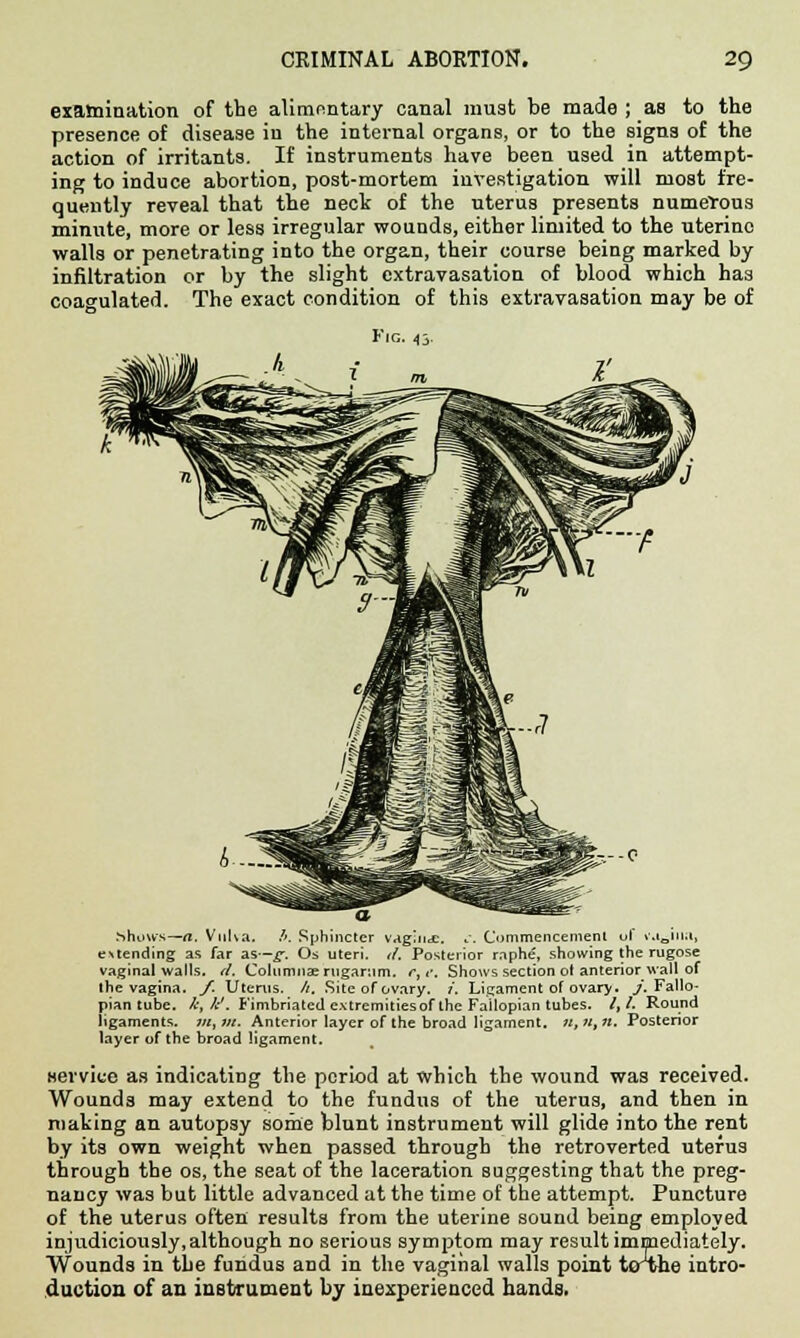 examination of the alimentary canal must be made ; as to the presence of disease in the internal organs, or to the signs of the action of irritants. If instruments have been used in attempt- ing to induce abortion, post-mortem investigation will most fre- quently reveal that the neck of the uterus presents numerous minute, more or less irregular wounds, either limited to the uterine walls or penetrating into the organ, their course being marked by infiltration or by the slight extravasation of blood which has coagulated. The exact condition of this extravasation may be of Fig. 43 Shows—a. Vulva. />. Sphincter vagina. .. Commencement of v.i0iua, euending as far as—g. Os uteri, il. Posterior raphe, showing the rugose vaginal walls, d. Columnaerugar.im. r, r. Shows section of anterior wall of the vagina. /. Uterus. /;. Site of ovary, i. Ligament of ovary. /. Fallo- pian tube, k,k'. Fimbriated cxtrcmitiesof the Fallopian tubes. /,/. Round ligaments. 711, lit. Anterior layer of the broad ligament. 11, «, h. Posterior layer of the broad ligament. service as indicating the period at which the wound was received. Wounds may extend to the fundus of the uterus, and then in making an autopsy some blunt instrument will glide into the rent by its own weight when passed through the retroverted uterus through the os, the seat of the laceration suggesting that the preg- nancy was but little advanced at the time of the attempt. Puncture of the uterus often results from the uterine sound being employed injudiciously,although no serious symptom may result immediately. Wounds in the fundus and in the vaginal walls point tcrthe intro- duction of an instrument by inexperienced hands.