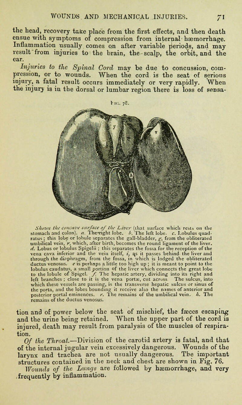 the head, recovery take place from the first effects, and then death ensue with symptoms of compression from internal1 hagmorrhage. Inflammation usually comes on after variable rjeriodjs, and may result from injuries to the brain, the-scalp, the orbit, and the ear. Injuries to the Spinal Cord may be due to concussion, com- pression, or to wounds. When the cord is the seat of serious injury, a fatal result occurs immediately or very rapidly. When the injury is in the dorsal or lumbar region there is loss of sensa- S/ioios the concave surface of the Liver (that surface which rests on (lie stomach and colon), rt. The*right lobe. /'. The left lobe. c. Lobulus quad- ratic ; this lobe or lobule separates the gall-bladder, g, from the obliterated umbilical vein, r, which, after birth, becomes the round ligament of the liver. H. Lobus or lobulus Spigclii ; this separates the fossa for the reception of the vena cava inferior and the vein itself, ;', a,s it passes behind the liver and through the diaphragm, from the fossa, in which is lodged the obliterated ductus venosus. e is perhaps a little too high up ; it is meant to point to the lobulus caudatus, a small portion of the liver which connects the great lobe to the lobule of Spigel. f. The hepatic artery, dividing into its right and left branches ; close to it is the vena porta;, cut across The sulcus, into which these vessels are passing, is the transverse hepatic sulcus or sinus of the porta, and the lobes bounding it receive also the names of anterior and posterior portal eminences, r. The remains of the umbilical vein. h. The remains of the ductus venosus. tion and of power below the seat of mischief, the faeces escaping and the urine being retained. When the upper part of the cord is injured, death may result from paralysis of the muscles of respira- tion. Of the Throat.—Division of the carotid artery is fatal, and that of the internal jugular vein excessively dangerous. Wounds of the larynx and trachea are not usually dangerous. Tbe important structures contained in the neck and chest are shown in Fig. 76. Wounds of the Limgs are followed by haemorrhage, and very .frequently by inflammation.