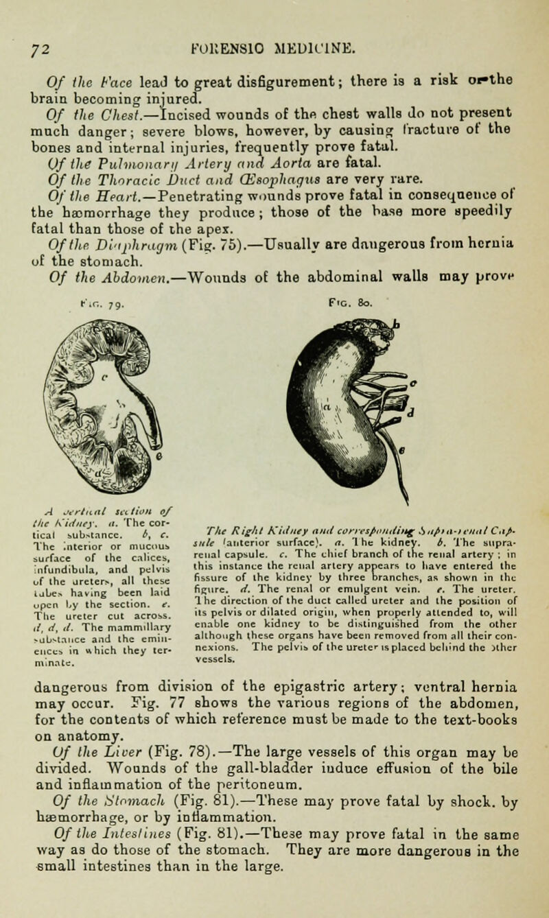 Of the Face lead to great disfigurement; there is a risk oi»the brain becoming injured. Of the Chest.—Incised wounds of the chest walls do not present much danger; severe blows, however, by causing fracture of the bones and internal injuries, frequently prove fatal. Of the Pulmonary Artery and Aorta are fatal. Of the Thoracic Duct and CEsophagxis are very rare. Of the Heart.—Penetrating wounds prove fatal in consequence of the haemorrhage they produce ; those of the base more speedily fatal than those of the apex. Of the Di'ijihragm (Fig. 75).—Usually are dangerous from hernia uf the stomach. Of the Abdomen.—Wounds of the abdominal walls may prove A MriitlU st-itioii of the Kidney, it. The cor- tical substance. P, c. The Interior or mucous surface of the calices, Infundibula, and pelvis uf the ureters, all these tubes having been laid upen by the section, e. The ureter cut across. d, d, d. The mammillary substance and the emin- ences in which they ter- minate. The Right Kidney ami corresfinttitiiig .Siifim-ietiittC.ifi- nite 'anterior surface), a. '1 he kidney. b. The supra- renal capsule, c. The chief branch of the renal artery ; in this instance the renal artery appears to have entered the fissure of the kidney by three branches, as shown in the figure, d. The renal or emulgent vein. e. The ureter. 1 he direction of the duct called ureter and the position of its pelvis or dilated origin, when properly attended to, will enable one kidney to be distinguished from the other although these organs have been removed from all their con- nexions. The pelvis of the ureter is placed behind the ilher vessels. dangerous from division of the epigastric artery; ventral hernia may occur. Fig. 77 Bhows the various regions of the abdomen, for the contents of which reference must be made to the text-books on anatomy. Of the Liver (Fig. 78).—The large vessels of this organ may be divided. Wounds of the gall-bladder induce effusion of the bile and inflammation of the peritoneum. Of the Stomach (Fig. 81).—These may prove fatal by shock, by hemorrhage, or by inflammation. Of the Intestines (Fig. 81).—These may prove fatal in the same way as do those of the stomach. They are more dangerous in the «mall intestines than in the large.