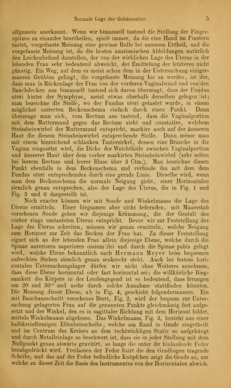 allgemein anerkannt. Wenn wir bimanuell tastend die Stellung der Fing spitzen zu einander beurtheilen, spielt immer, da die eine Hand im Finstero tastet, vorgefasste Meinung eine gewisse Rolle bei unserem Urtheil, und die vorgefasste Meinung ist, da die besten anatomischen Abbildungen natürlich den Leichenbefund darstellen, der von der wirklichen Lage des Uterus in der lebenden Frau sehr bedeutend abweicht, der Emittelung der letzteren nicht günstig. Ein Weg. auf dem es meist schon dem in der Untersuchung einiger- massen Geübten gelingt, die vorgefasste Meinung los zu werden, ist der. dass man in Rückenlage der Frau von der vorderen Vaginal wand und von-den Bauchdecken aus bimanuell tastend sich davon überzeugt, dass der Fundus uteri hinter der Symphyse, meist etwas oberhalb derselben gelegen ist: man bezeichne die Stelle, wo der Fundus uteri getastet wurde, in einem möglichst correcten Beckenschema einfach durch einen Punkt. Dann überzeuge man sich, vom Rectum aus tastend, dass die Vaginalportion mit dem Muttermund gegen das Rectum sieht und constatire, welchem Steissbeinwirbel der Muttermund entspricht, markire auch auf der äusseren Haut die diesem Steissbeinwirbel entsprechende Stelle. Dann messe man mit einem hinreichend schlanken Tasterzirkel, dessen eine Branche in die Vagina eingesetzt wird, die Dicke der Weichtheile zwischen Vaginalportion und äusserer Haut über dem vorher markirten Steissbeinwirbel (sehr selten bei leerem Rectum und leerer Blase über 3 Ctm.). Man bezeichne diesen Punkt ebenfalls in dem Beckenschema und verbinde ihn mit dem dem Fundus uteri entsprechenden durch eine gerade Linie. Dieselbe wird, wenn man dem Beckenschema die normale Neigung giebt, einer Horizontalen ziemlich genau entsprechen, also der Lage des Uterus, die in Fig. 1 und Fig. 5 und 6 dargestellt ist. Noch exaeter können wir mit Sonde und YYinkelmaass die Laut- des rus ermitteln. Einer biegsamen aber nicht federnden, mit Maassstab versehenen Sonde geben wir diejenige Krümmung, die der Gestalt des vorher rings umtasteten Uterus entspricht. Bevor wir zur Feststellung der Lage des Uterus schreiten, müssen wir genau ermitteln, welche Neigung zum Horizont zur Zeit das Becken der Frau hat. Zu dieser Feststellung eignet sich an der lebenden Frau allein diejenige Ebene, welche durch die Spinae anteriores superiores ossium ilei und durch die Spinae pubis geleüi wird, welche Ebene bekanntlich nach Hermann Meyer beim bequemen aufrechten Stehen ziemlich genau senkrecht steht. Auch bei festem hori- zontalen Untersuchungslager dürfen wir nicht ohne Weiteres annehmen, dass diese Ebene horizontal oder fast horizontal sei: die willkürliche B; samkeit des Körpers in der Lendengegend ist so bedeutend, dass Irruii_ um 20 und 30° und mehr durch solche Annahme stattfinden könnten. Die Messung dieser Ebene, ab in Fig. 4, geschieht folgendennassen. Ein mit Bauchausschnitt versehenes Brett, Fig. *2. wird der bequem zur Unter- suchung gelagerten Frau auf die genannten Punkte gleichmässig fest aufg - setzt und der Winkel, den es in sagittaler Richtung mit dem Horizont bildet, mittels Winkelmaass abgelesen. Das Winkelmaa». Fig. 3, besteht aus einer halbkreisförmigen EDlfenbeinscheibe, welche am Rand in Grade eingetheill und im Centrum des Kreises an dem rechtwinkligen Stativ so aufgehängt und durch Metalleinlage so beschwert ist. dass sie m jeder Stellung mit dem Nullpunkt genau abwärts grayitirt, so lange die unter ihr hinlaufende Feder berabgedrückt wird. Freilassen der Feder lixirt die den Gradbogen tragende Scheibe, und das auf der Feder befindliche Knöpfchen zeigt die Grade an, um welche zu dieser Zeit die Basis des Instrumentes von der Horizontalen abwich.