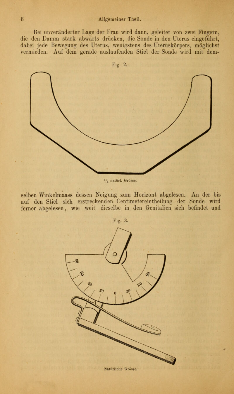 Bei unveränderter Lage der Frau wird dann, geleitet von zwei Fingern, die den Damm stark abwärts drücken, die Sonde in den Uterus eingeführt, dabei jede Bewegung des Uterus, wenigstens des Uteruskörpers, möglichst vermieden. Auf dem gerade auslaufenden Stiel der Sonde wird mit dem- 'iff 2. '/3 natürl. Grösse. selben Winkelmaass dessen Neigung zum Horizont abgelesen. An der bis auf den Stiel sich erstreckenden Centimetereintheilung der Sonde wird ferner abgelesen, wie weit dieselbe in den Genitalien sich befindet und Fig. 3. Natürliche Grösse.