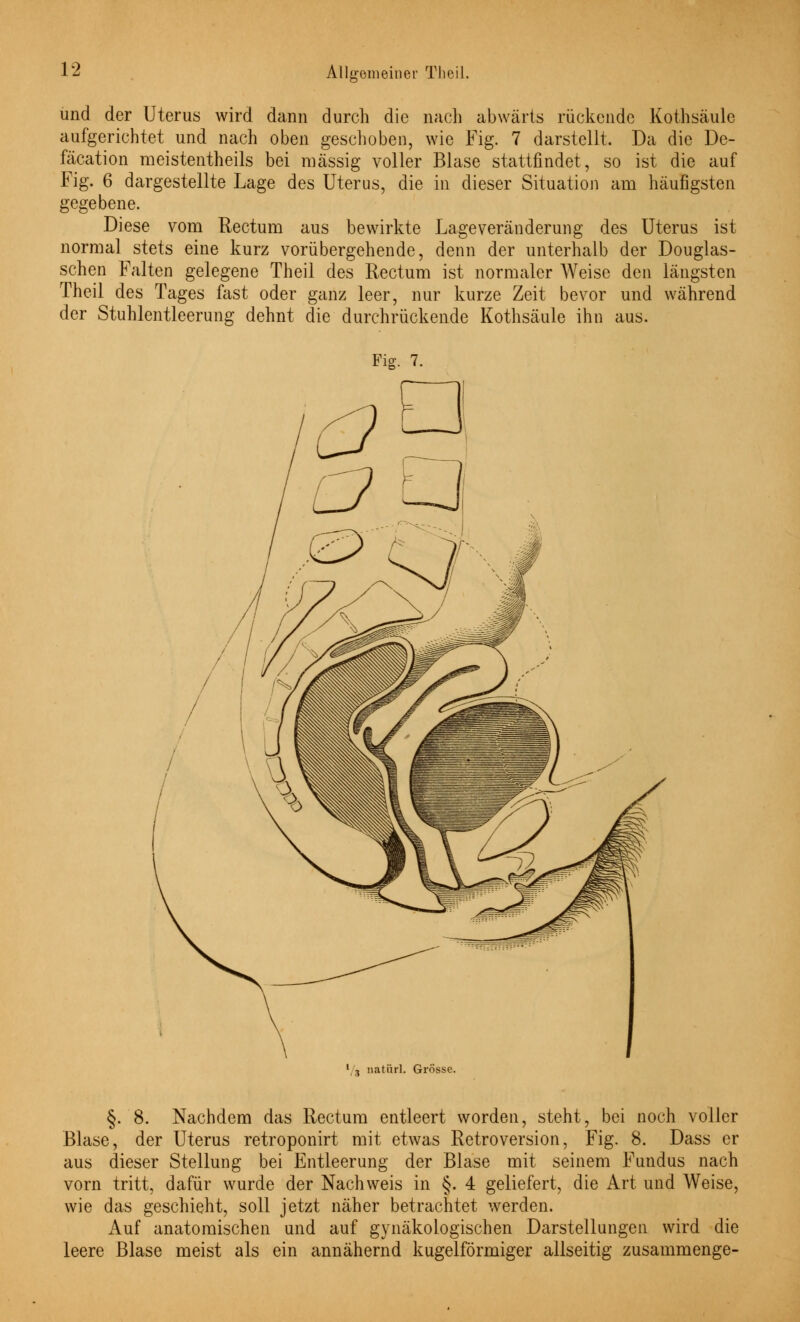 und der Uterus wird dann durch die nach abwärts rückende Kothsäule aufgerichtet und nach oben geschoben, wie Fig. 7 darstellt. Da die De- fäcation meistenteils bei massig voller Blase stattfindet, so ist die auf Fig. 6 dargestellte Lage des Uterus, die in dieser Situation am häufigsten gegebene. Diese vom Rectum aus bewirkte Lageveränderung des Uterus ist normal stets eine kurz vorübergehende, denn der unterhalb der Douglas- schen Falten gelegene Theil des Rectum ist normaler Weise den längsten Theil des Tages fast oder ganz leer, nur kurze Zeit bevor und während der Stuhlentleerung dehnt die durchrückende Kothsäule ihn aus. Fig. 7. 1 j natiirl. Grosse. §. 8. Nachdem das Rectum entleert worden, steht, bei noch voller Blase, der Uterus retroponirt mit etwas Retroversion, Fig. 8. Dass er aus dieser Stellung bei Entleerung der Blase mit seinem Fundus nach vorn tritt, dafür wurde der Nachweis in §. 4 geliefert, die Art und Weise, wie das geschieht, soll jetzt näher betrachtet werden. Auf anatomischen und auf gynäkologischen Darstellungen wird die leere Blase meist als ein annähernd kugelförmiger allseitig zusammenge-