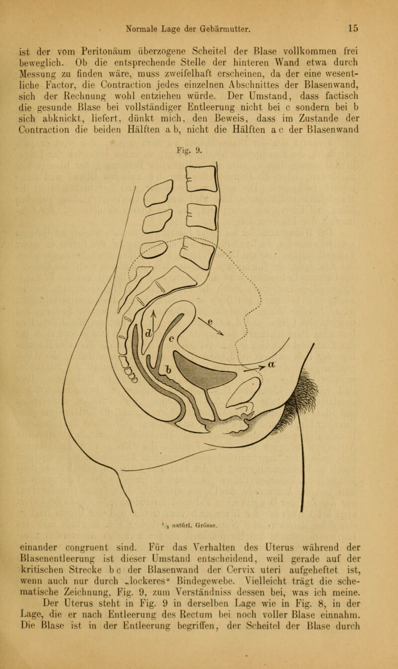ist der vom Peritonäum überzogene Scheitel der Blase vollkommen frei beweglich. Ob die entsprechende Stelle der hinteren Wand etwa durch Messung zu finden wäre, muss zweifelhaft erscheinen, da der eine wesent- liche Factor, die Contraction jedes einzelnen Abschnittes der Blasenwand, sich der Rechnung wohl entziehen würde. Der Umstand, dass factisch die gesunde Blase bei vollständiger Entleerung nicht bei c sondern bei b sich abknickt, liefert, dünkt mich, den Beweis, dass im Zustande der Contraction die beiden Hälften ab, nicht die Hälften ac der Blasenwand Fig. 9. i natürL (Jp einander congruent sind. Für das Verhalten des Uterus während der Blasenentleerung ist dieser Umstand entscheidend, weil gerade auf der kritischen Strecke bc der Blasenwand der (Vrvi\ uteri aufgeheftet ist, wenn auch nur durch „lockeres4 Bindegewebe. Vielleicht trägt die sehe- matische Zeichnung, Fig. 9, zum Verstandniss dessen bei, was ich meine. Der Uterus steht in Fig. 9 in derselben Lage wie in Fig. 8, in der Lage, die er nach Entleerung des Rectum bei noch voller Blase einnahm. Die Blase ist in der Kntleerung begriffen, der Scheitel der Blase durch