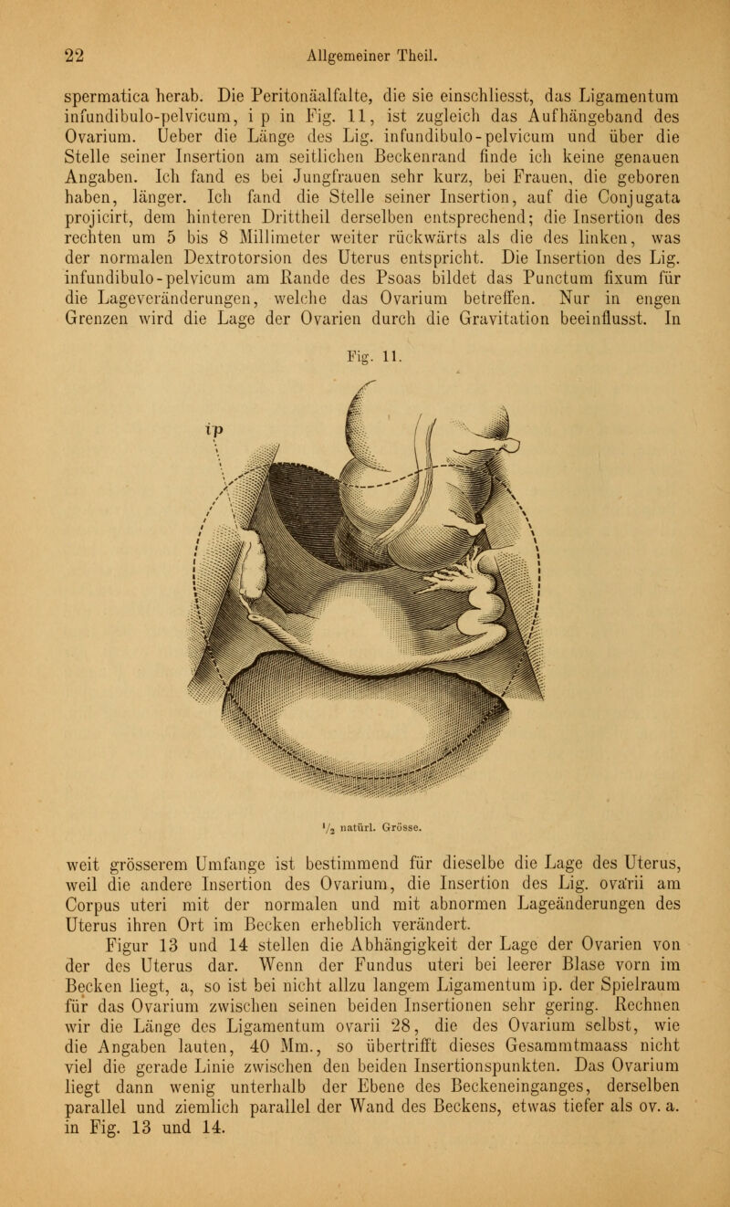 spermatica herab. Die Peritonäalfalte, die sie einschliesst, das Ligamentum infundibulo-pelvicum, ip in Fig. 11, ist zugleich das Aufhängeband des Ovarium. Ueber die Länge des Lig. infundibulo-pelvicum und über die Stelle seiner Insertion am seitlichen Beckenrand finde ich keine genauen Angaben. Ich fand es bei Jungfrauen sehr kurz, bei Frauen, die geboren haben, länger. Ich fand die Stelle seiner Insertion, auf die Conjugata projicirt, dem hinteren Drittheil derselben entsprechend; die Insertion des rechten um 5 bis 8 Millimeter weiter rückwärts als die des linken, was der normalen Dextrotorsion des Uterus entspricht. Die Insertion des Lig. infundibulo-pelvicum am Rande des Psoas bildet das Punctum fixum für die Lageveränderungen, welche das Ovarium betreffen. Nur in engen Grenzen wird die Lage der Ovarien durch die Gravitation beeinflusst. In Fig. 11. ■ ■■■'••>r:$&&!fä!$f?.2tZ:!fr!f-';- '/2 natürl. Grösse. weit grösserem Umfange ist bestimmend für dieselbe die Lage des Uterus, weil die andere Insertion des Ovarium, die Insertion des Lig. ova'rii am Corpus uteri mit der normalen und mit abnormen Lageänderungen des Uterus ihren Ort im Becken erheblich verändert. Figur 13 und 14 stellen die Abhängigkeit der Lage der Ovarien von der des Uterus dar. Wenn der Fundus uteri bei leerer Blase vorn im Becken liegt, a, so ist bei nicht allzu langem Ligamentum ip. der Spielraum für das Ovarium zwischen seinen beiden Insertionen sehr gering. Rechnen wir die Länge des Ligamentum ovarii 28, die des Ovarium selbst, wie die Angaben lauten, 40 Mm., so übertrifft dieses Gesammtmaass nicht viel die gerade Linie zwischen den beiden Insertionspunkten. Das Ovarium liegt dann wenig unterhalb der Ebene des Beckeneinganges, derselben parallel und ziemlich parallel der Wand des Beckens, etwas tiefer als ov. a. in Fig. 13 und 14.