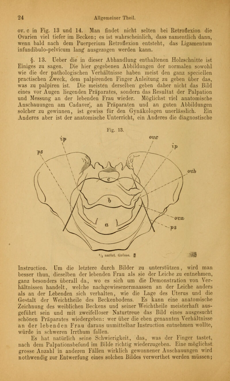 ov. c in Fig. 13 und 14. Man findet nicht selten bei Retroflexion die Ovarien viel tiefer im Becken: es ist wahrscheinlich, dass namentlich dann, wenn bald nach dem Puerperium Retroflexion entsteht, das Ligamentum infundibulo-pelvicum lang ausgezogen werden kann. §. 13. Ueber die in dieser Abhandlung enthaltenen Holzschnitte ist Einiges zu sagen. Die hier gegebenen Abbildungen der normalen sowohl wie die der pathologischen Verhältnisse haben meist den ganz speciellen practischen Zweck, dem palpirenden Finger Anleitung zu geben über das, was zu palpiren ist. Die meisten derselben geben daher nicht das Bild eines vor Augen liegenden Präparates, sondern das Resultat der Palpation und Messung an der lebenden Frau wieder. Möglichst viel anatomische Anschauungen am Cadaverj, an Präparaten und an guten Abbildungen solcher zu gewinnen, ist gewiss für den Gynäkologen unerlässlich. Ein Anderes aber ist der anatomische Unterricht, ein Anderes die diagnostische Fig. 13. oub 3 natürl. Grosse. 0 Instruction. Um die letztere durch Bilder zu unterstützen, wird man besser thun, dieselben der lebenden Frau als sie der Leiche zu entnehmen, ganz besonders überall da, wo es sich um die Demonstration von Ver- hältnissen handelt, welche nachgewiesenermaassen an der Leiche anders als an der Lebenden sich verhalten, wie die Lage des Uterus und die Gestalt der Weichtheile des Beckenbodens. Es kann eine anatomische Zeichnung: des weiblichen Beckens und seiner Weichtheile meisterhaft aus- geführt sein und mit zweifelloser Naturtreue das Bild eines ausgesucht schönen Präparates wiedergeben: wer über die eben genannten Verhältnisse an der lebenden Frau daraus unmittelbar Instruction entnehmen wollte, würde in schweren Irrthum fallen. Es hat natürlich seine Schwierigkeit, das, was der Finger tastet, nach dem Palpationsbefund im Bilde richtig wiederzugeben. Eine möglichst grosse Anzahl in anderen Fällen wirklich gewonnener Anschauungen wird nothwendig zur Entwerfung eines solchen Bildes verwerthet werden müssen;