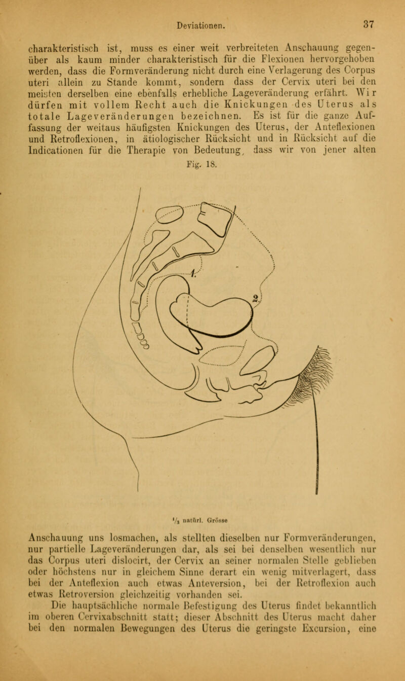 charakteristisch ist, muss es einer weit verbreiteten Anschauung gegen- über als kaum minder charakteristisch für die Flexionen hervorgehoben werden, dass die Formveränderung nicht durch eine Verlagerung des Corpus uteri allein zu Stande kommt, sondern dass der Cervix uteri bei den meisten derselben eine ebenfalls erhebliche Lageveränderung erfährt. Wir dürfen mit vollem Recht auch die Knickungen des Uterus als totale Lageveränderungen bezeichnen. Es ist für die ganze Auf- fassung der weitaus häufigsten Knickungen des Uterus, der Anteflexionen und Retroflexionen, in ätiologischer Rücksicht und in Rücksicht auf die Indicationen für die Therapie von Bedeutung, dass wir von jener alten Fig. 18. '/$ natürl. Grösse Anschauung uns losmachen, als stellten dieselben nur Formveränderungen, nur partielle Lageveränderungen dar, als sei bei denselben wesentlich nur das Corpus uteri dislocirt, der Cervix an Beiner normalen Stelle geblieben oder höchstens nur In gleichem Sinne derart ein wenig mitverlagert, dass bei der Anteflexion auch etwas Anteversion, bei der Retroflexion auch etwas Etetroversion gleichzeitig vorhanden sei. Die hauptsächliche normale Befestigung des Uterus finde! bekanntlich im oberen Cervixabschnitl statt; dieser Abschnitt des Uterus mach! daher bei den normalen Bewegungen des Uterus die geringste Excursion, eine