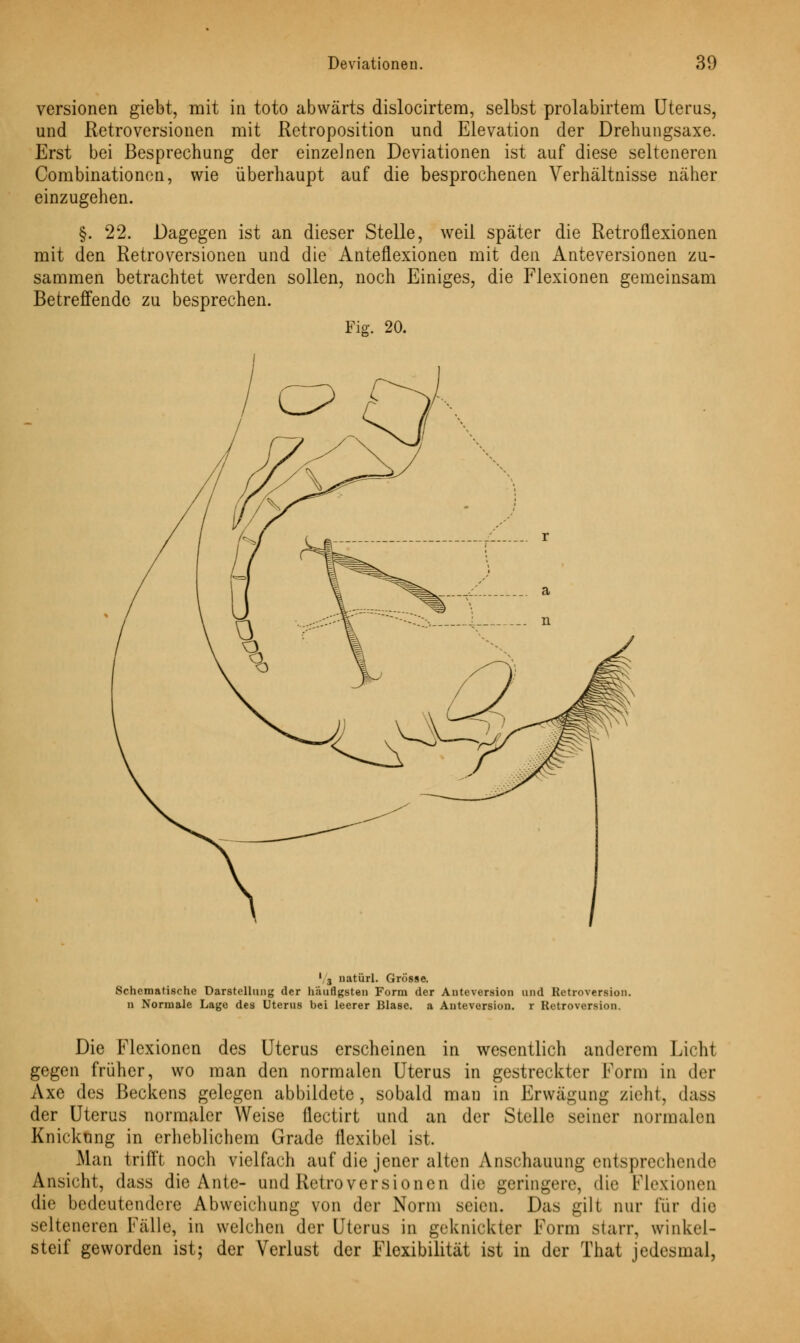 Versionen giebt, mit in toto abwärts dislocirtem, selbst prolabirtem Uterus, und Retroversionen mit Retroposition und Elevation der Drehungsaxe. Erst bei Besprechung der einzelnen Deviationen ist auf diese selteneren Combinationen, wie überhaupt auf die besprochenen Verhältnisse näher einzugehen. §. 22. Dagegen ist an dieser Stelle, weil später die Retroflexionen mit den Retroversionen und die Anteflexionen mit den Anteversionen zu- sammen betrachtet werden sollen, noch Einiges, die Flexionen gemeinsam Betreffende zu besprechen. Fig. 20. 1 3 natürl. Grösse. Schematische Darstellung der häufigsten Form der Anteversion und Kctroversion. n Normale Lage des Uterus bei leerer Blase, a Antevorsion. r Retroversimi Die Flexionen des Uterus erscheinen in wesentlich anderem Licht gegen früher, wo man den normalen Uterus in gestreckter Form in der Axe des Beckens gelegen abbildete, sobald man in Erwägung zieht, dass der Uterus normaler Weise flectirt und an der Stelle seiner normalen Knickung in erheblichem Grade flexibel ist. Man trifft noch vielfach auf die jener alten Anschauung entsprechende Ansicht, dass die Ante- und Retroversionen die geringere, die Flexionen die bedeutendere Abweichung von der Norm seien. Das gilt nur für die selteneren Falle, in welchen der Uterus in geknickter Form starr, winkel- steif geworden ist; der Verlust der Flexibilität ist in der That jedesmal,