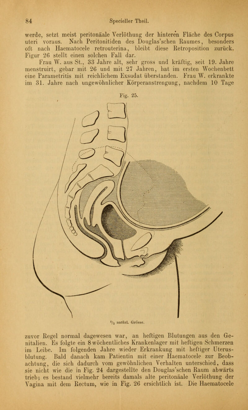 werde, setzt meist peritonäale Verlöthung der hinteren Fläche des Corpus uteri voraus. Nach Peritonitiden des Douglas'schen Raumes, besonders oft nach Haematocele retrouterina, bleibt diese Retroposition zurück. 26 stellt einen solchen Fall dar. Frau W. aus St., 33 Jahre alt, sehr gross und kräftig, seit 19. Jahre menstruirt, gebar mit 26 und mit 27 Jahren, hat im ersten Wochenbett eine Parametritis mit reichlichem Exsudat überstanden. Frau W. erkrankte im 31. Jahre nach ungewöhnlicher Körperanstrengung, nachdem 10 Tage Figur Fig. 25. Vs natürl. Grösse. zuvor Regel normal dagewesen war, an heftigen Blutungen aus den Ge- nitalien. Es folgte ein 8 wöchentliches Krankenlager mit heftigen Schmerzen im Leibe. Im folgenden Jahre wieder Erkrankung mit heftiger Uterus- blutung. Bald danach kam Patientin mit einer Haematocele zur Beob- achtung, die sich dadurch vom gewöhnlichen Verhalten unterschied, dass sie nicht wie die in Fig. 24 dargestellte den Douglas'schen Raum abwärts trieb; es bestand vielmehr bereits damals alte peritonäale Verlöthung der Vagina mit dem Rectum, wie in Fig. 26 ersichtlich ist. Die Haematocele