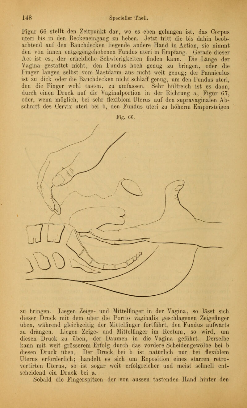 Figur 66 stellt den Zeitpunkt dar, wo es eben gelungen ist, das Corpus uteri bis in den Beckeneingang zu heben. Jetzt tritt die bis dahin beob- achtend auf den Bauchdecken liegende andere Hand in Action, sie nimmt den von innen entgegengehobenen Fundus uteri in Empfang. Gerade dieser Act ist es, der erhebliche Schwierigkeiten finden kann. Die Länge der Vagina gestattet nicht, den Fundus hoch genug zu bringen, oder die Finger langen selbst vom Mastdarm aus nicht weit genug; der Panniculus ist zu dick oder die Bauchdecken nicht schlaff genug, um den Fundus uteri, den die Finger wohl tasten, zu umfassen. Sehr hülfreich ist es dann, durch einen Druck auf die Vaginalportion in der Richtung a, Figur 67, oder, wenn möglich, bei sehr flexiblem Uterus auf den supravaginalen Ab- schnitt des Cervix uteri bei b, den Fundus uteri zu höherm Emporsteigen Fig. 66. zu bringen. Liegen Zeige- und Mittelfinger in der Vagina, so lässt sich dieser Druck mit dem über die Portio vaginalis geschlagenen Zeigefinger üben, während gleichzeitig der Mittelfinger fortfährt, den Fundus aufwärts zu drängen. Liegen Zeige- und Mittelfinger im Rectum, so wird, um diesen Druck zu üben, der Daumen in die Vagina geführt. Derselbe kann mit weit grösserem Erfolg durch das vordere Scheidengewölbe bei b diesen Druck üben. Der Druck bei b ist natürlich nur bei flexiblem Uterus erforderlich; handelt es sich um Reposition eines starren retro- vertirten Uterus, so ist sogar weit erfolgreicher und meist schnell ent- scheidend ein Druck bei a. Sobald die Fingerspitzen der von aussen tastenden Hand hinter den