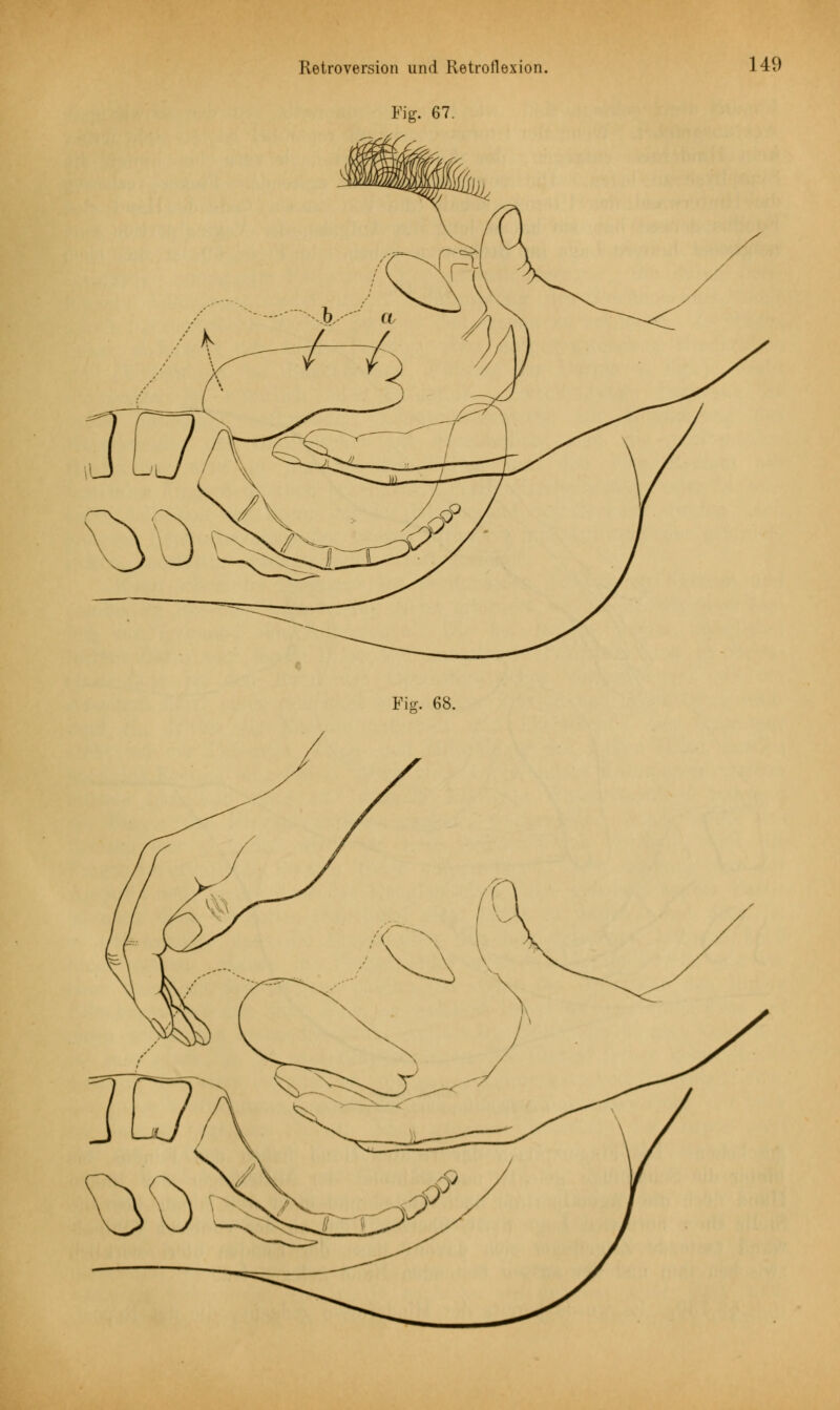 Fig. 67. Fig. 68.